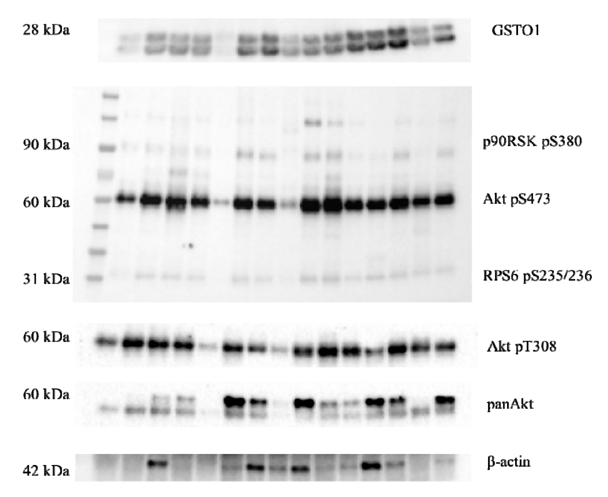 Cancers 11 02038 g004 Cancers 11 02038 g004
