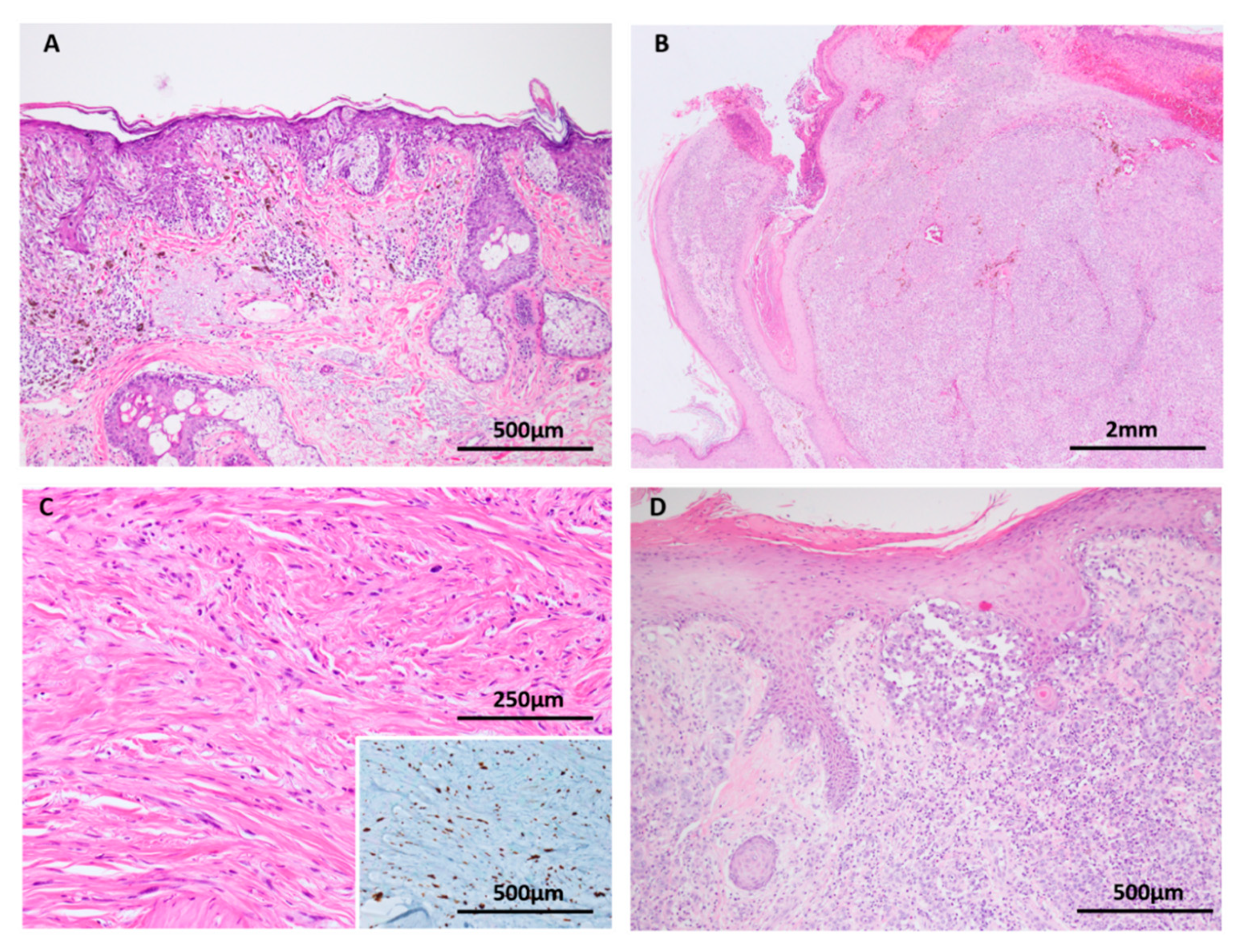 Cancers 11 02041 g008
