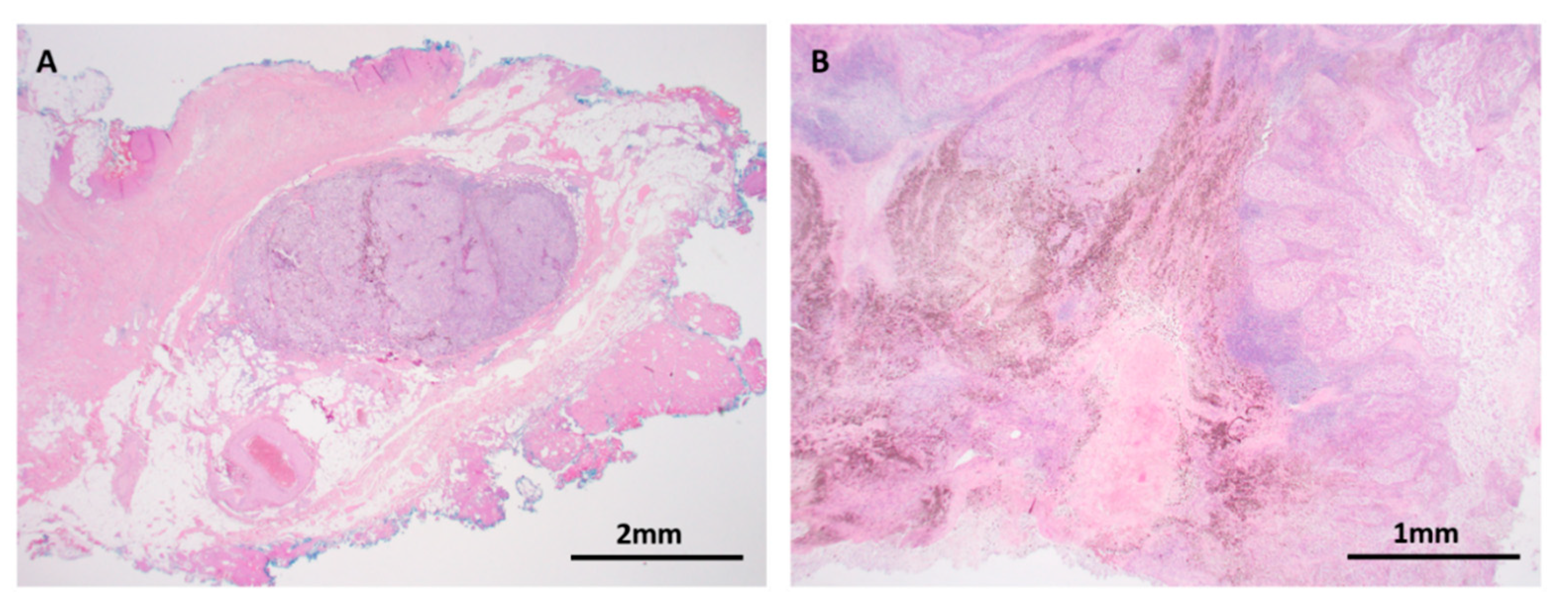 Cancers 11 02041 g009