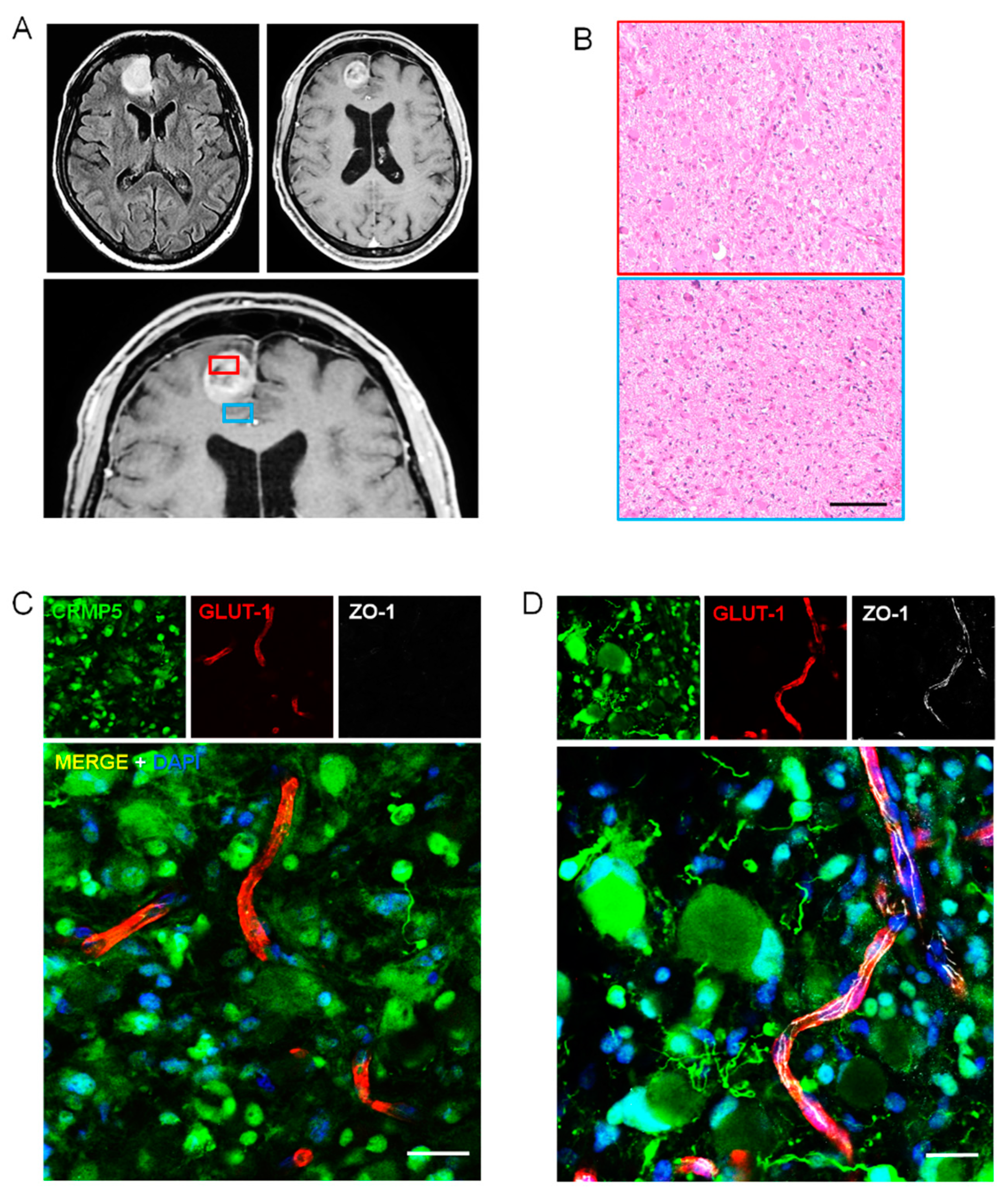 Cancers 12 00018 g004