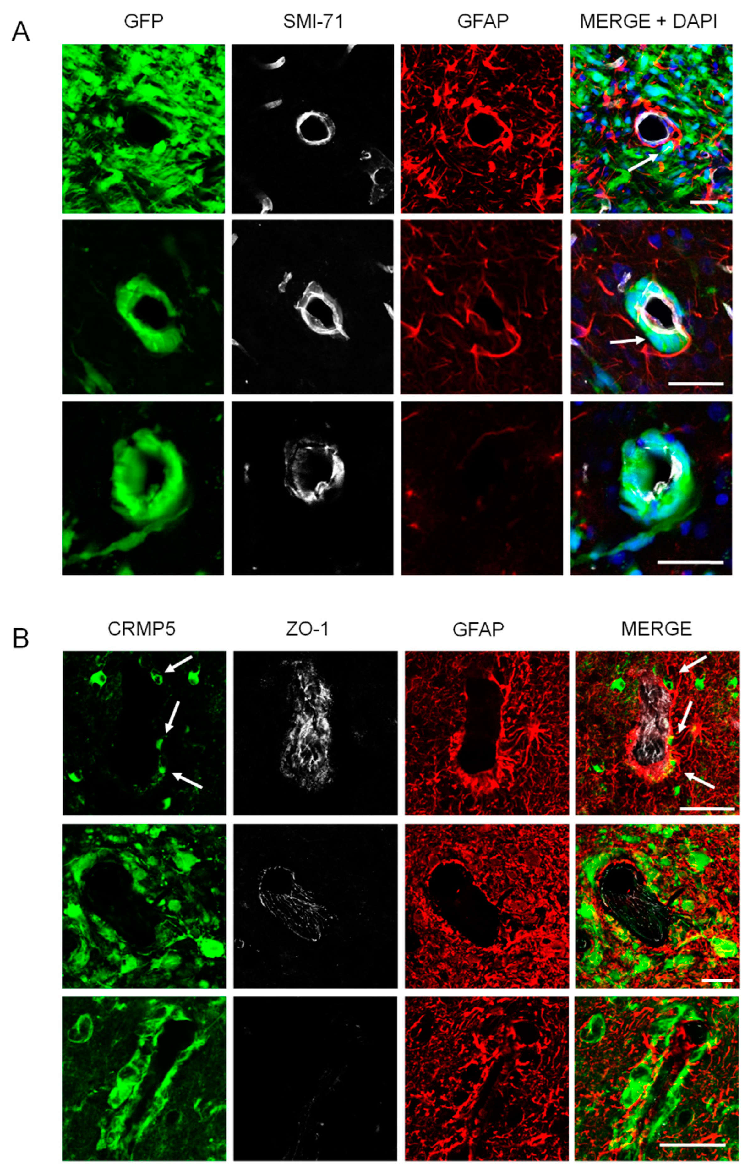 Cancers 12 00018 g005