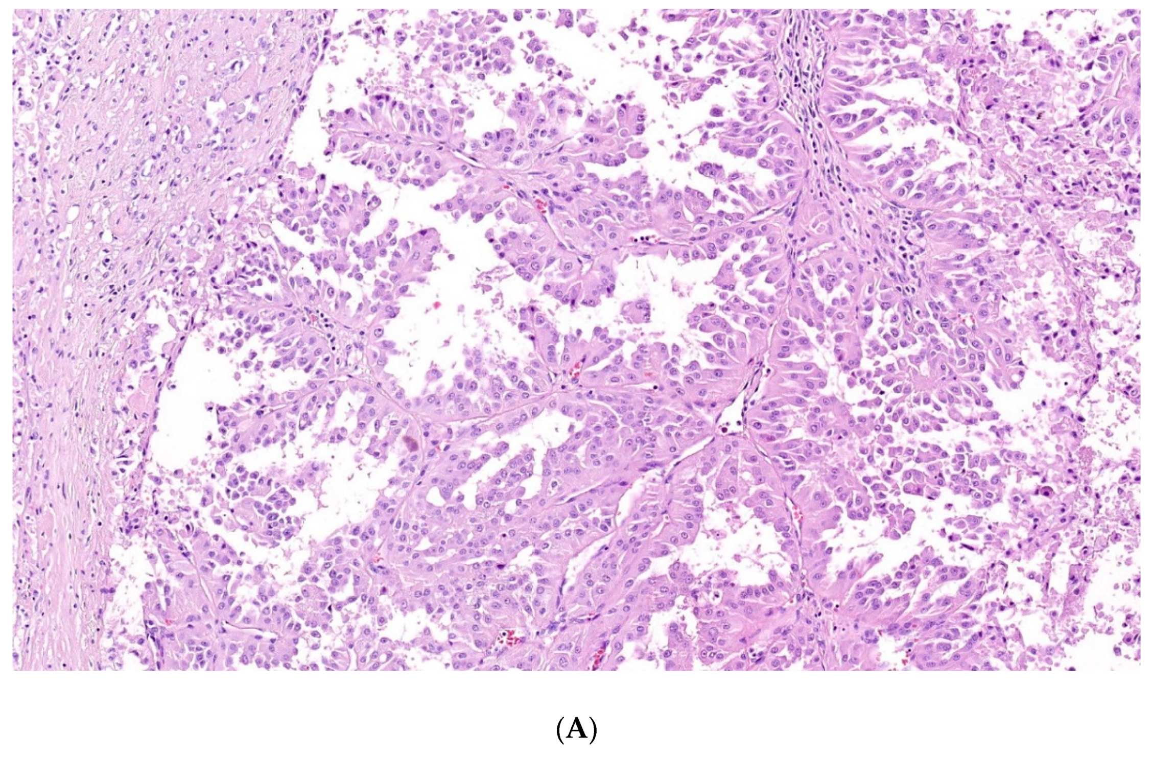 Cancers 12 00085 g003a Cancers 12 00085 g003a