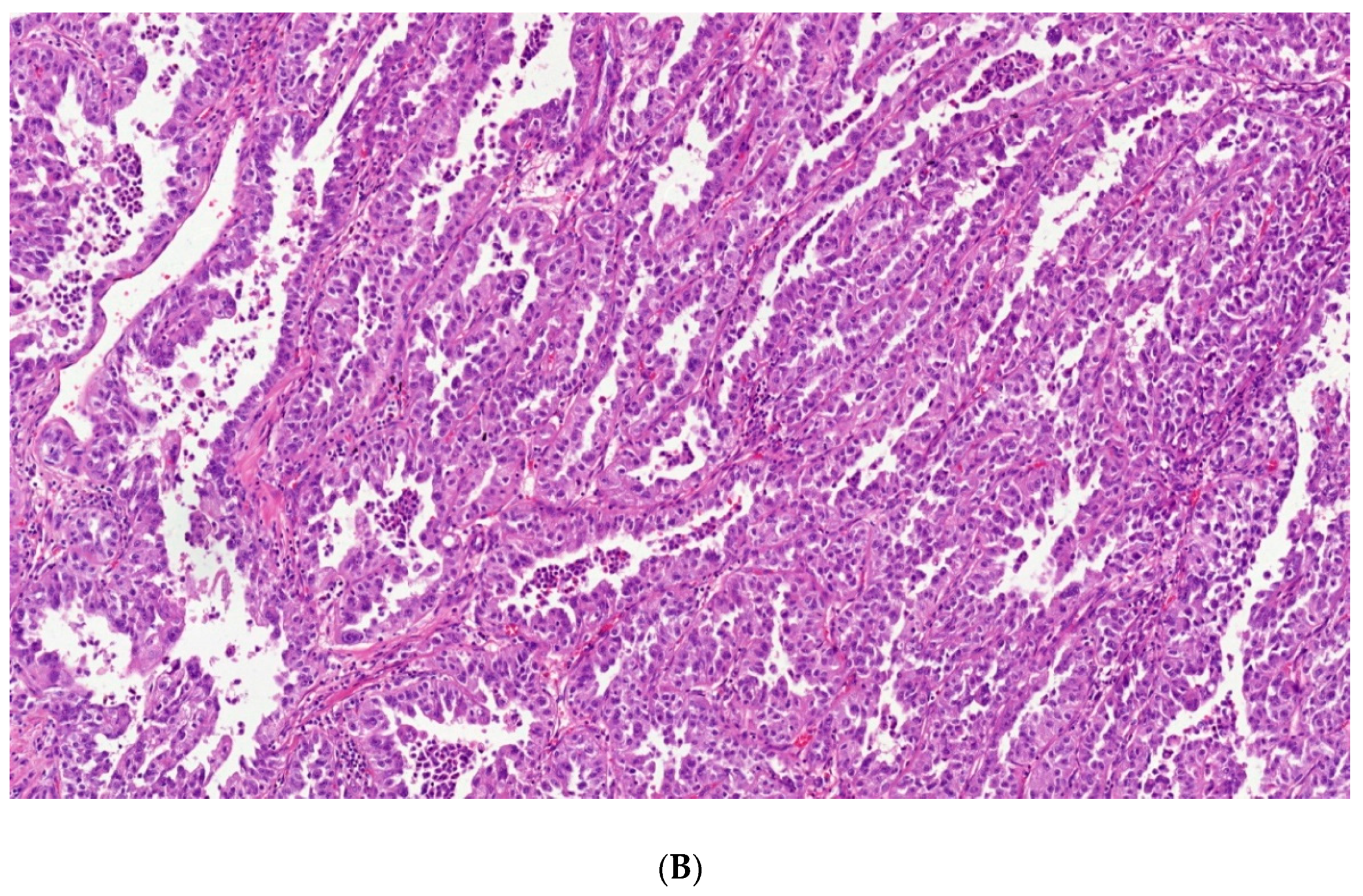 Cancers 12 00085 g003b Cancers 12 00085 g003b