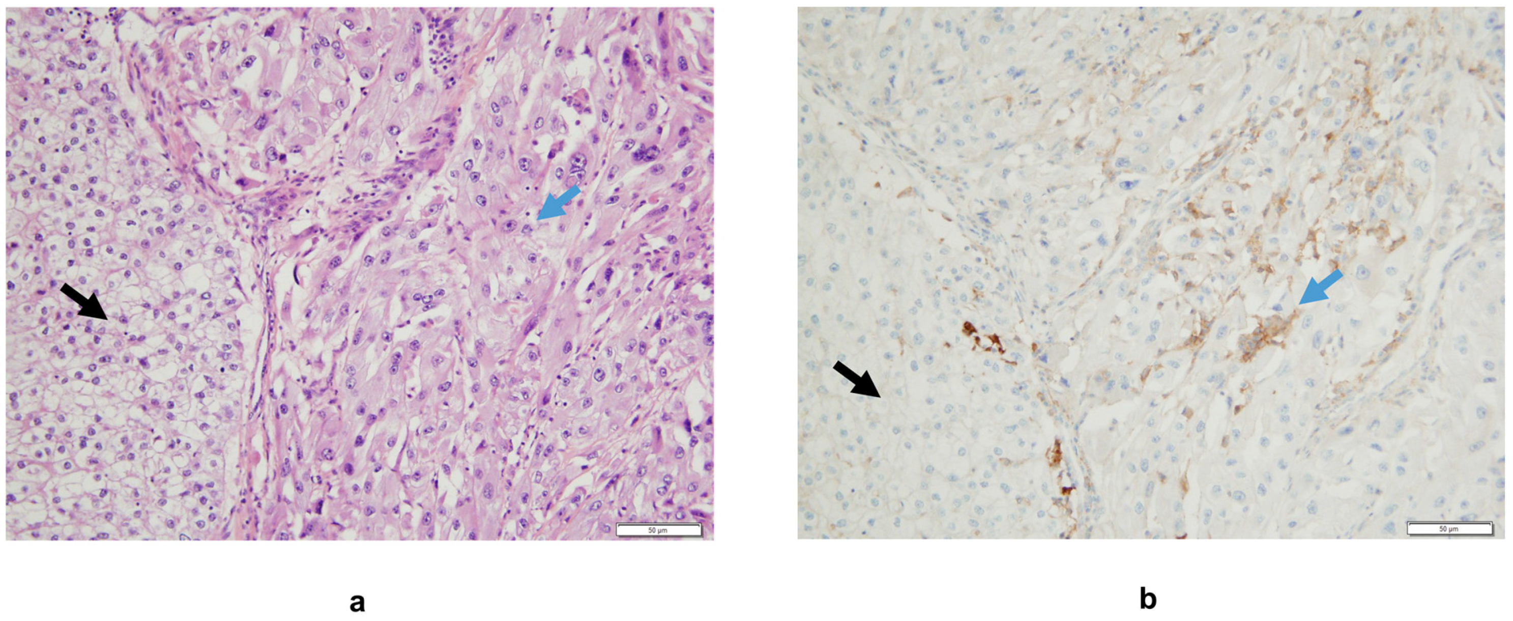 Cancers 12 00099 g002