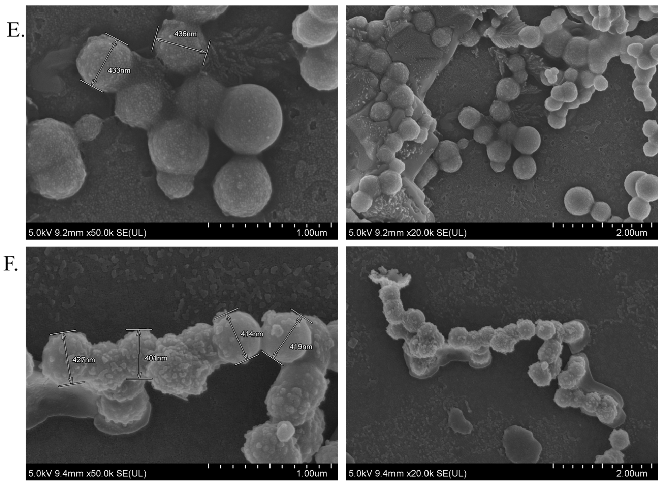 Cancers 12 00161 g009b