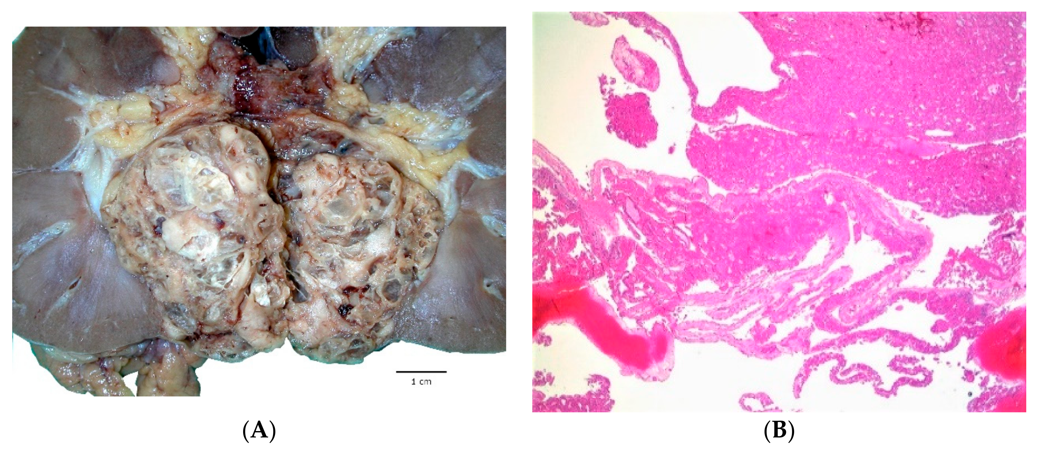 Cancers 12 00168 g001a