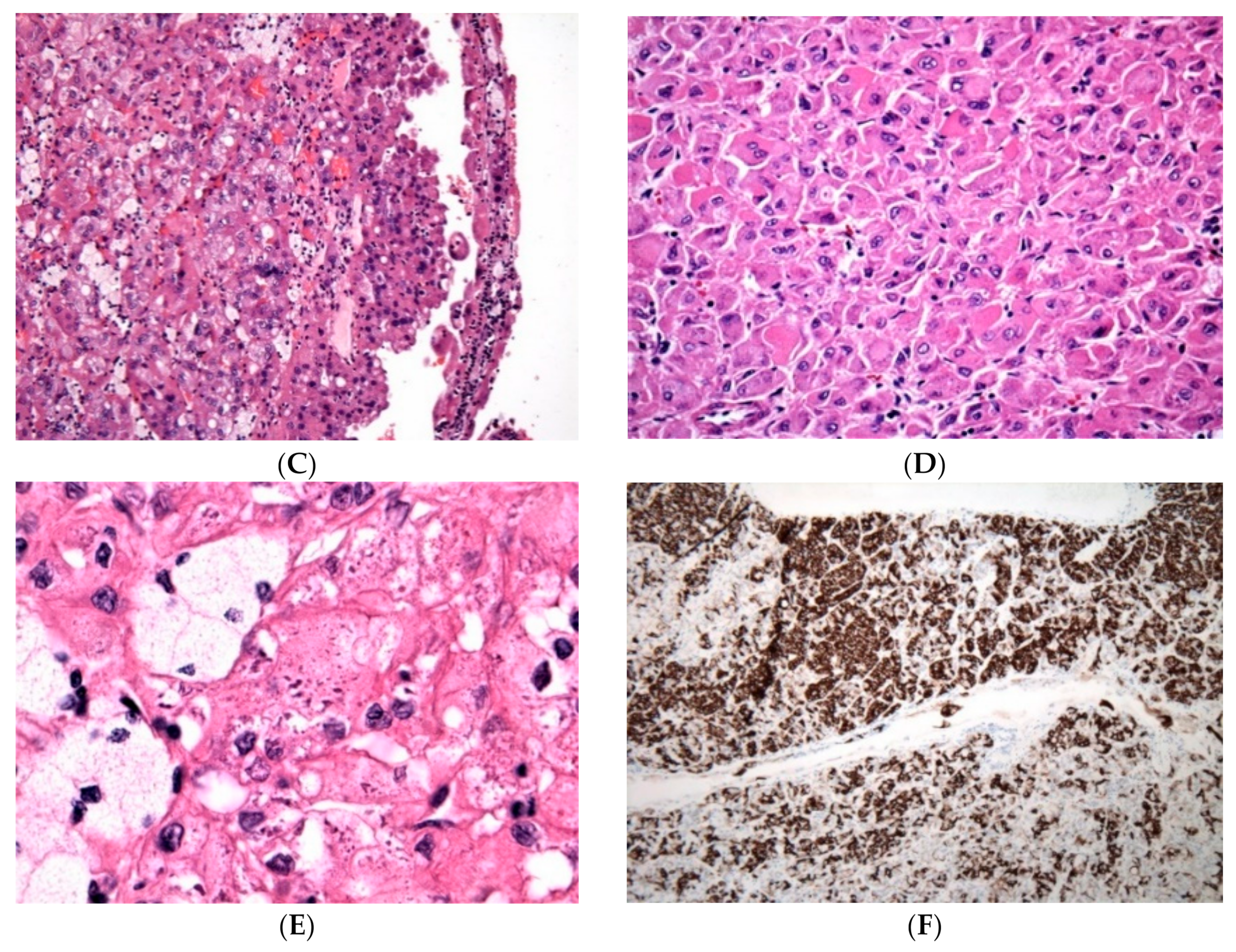 Cancers 12 00168 g001b