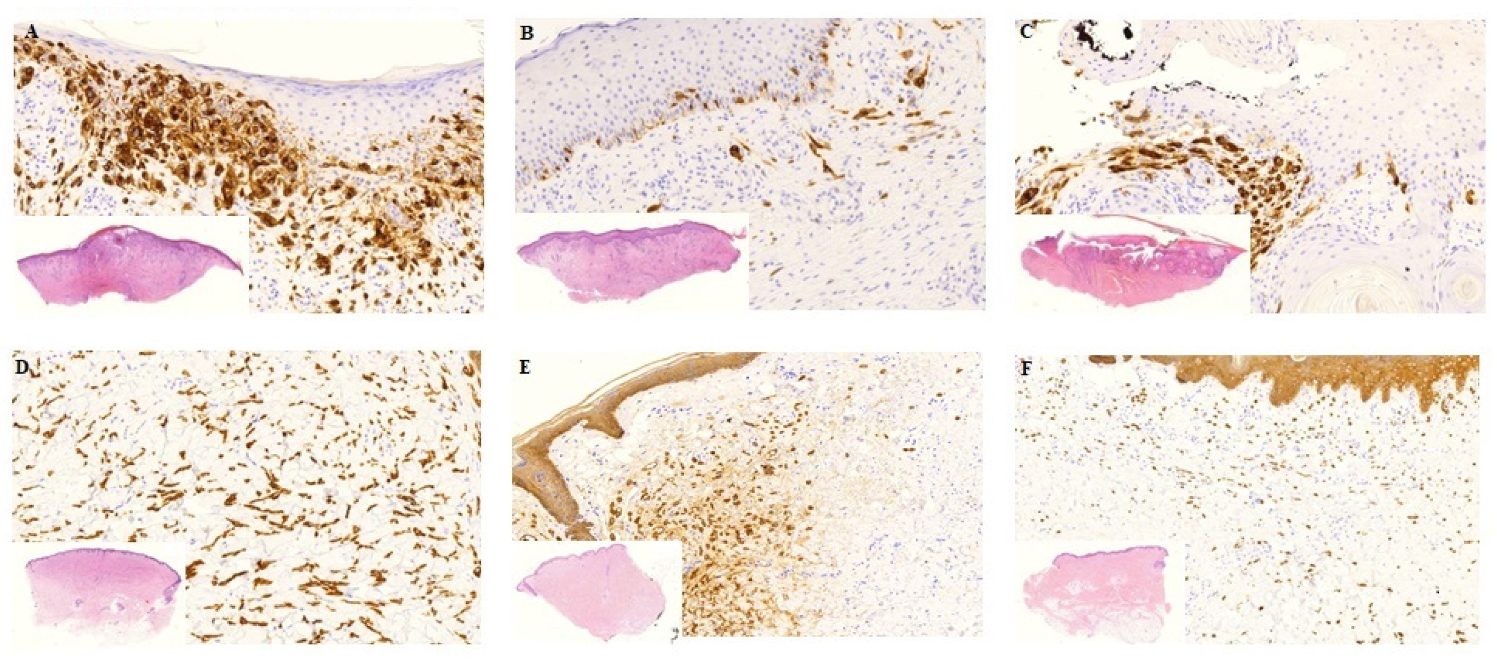 Cancers 12 00179 g002 Cancers 12 00179 g002