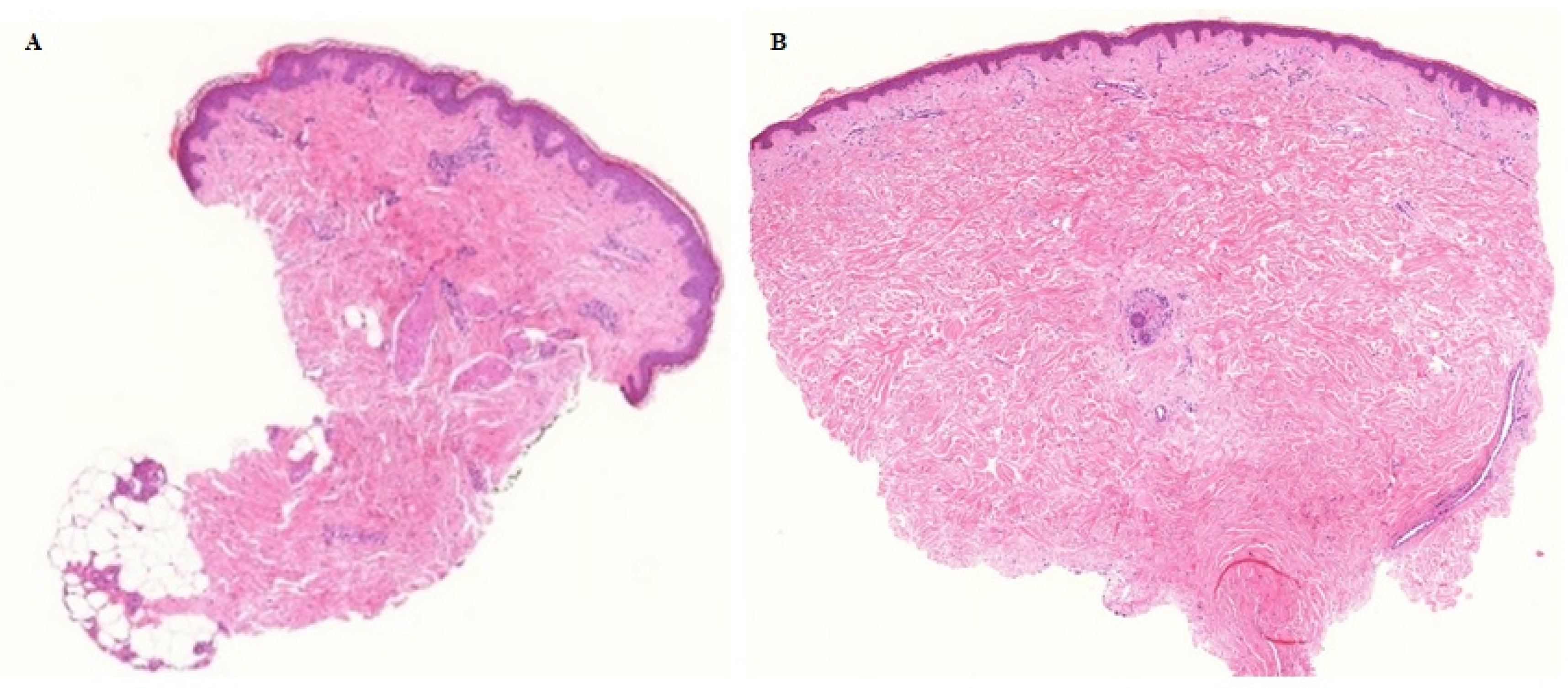 Cancers 12 00179 g004 Cancers 12 00179 g004
