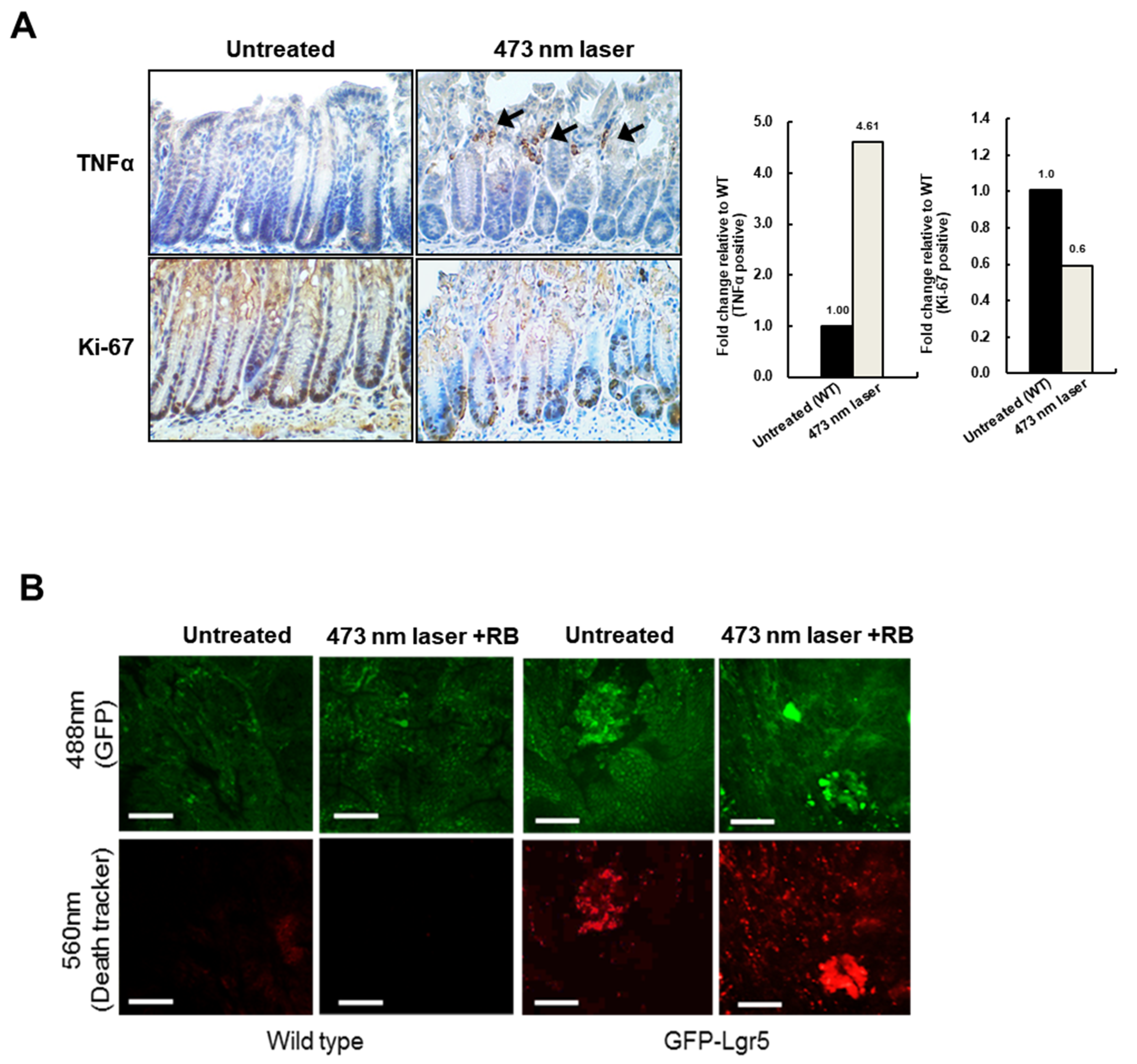 Cancers 12 00203 g004