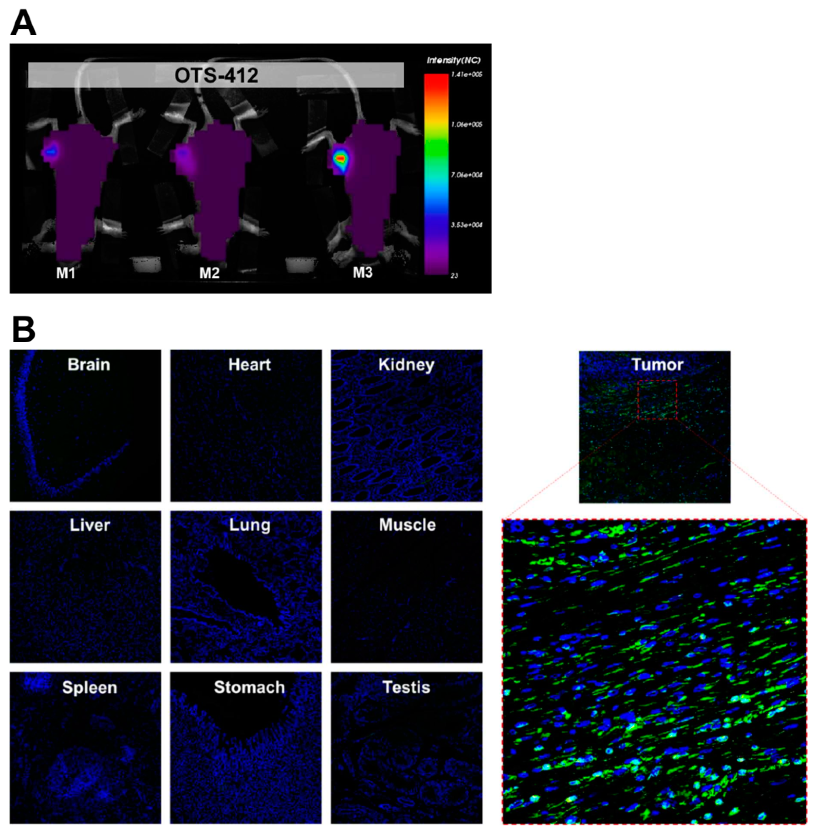 Cancers 12 00228 g004