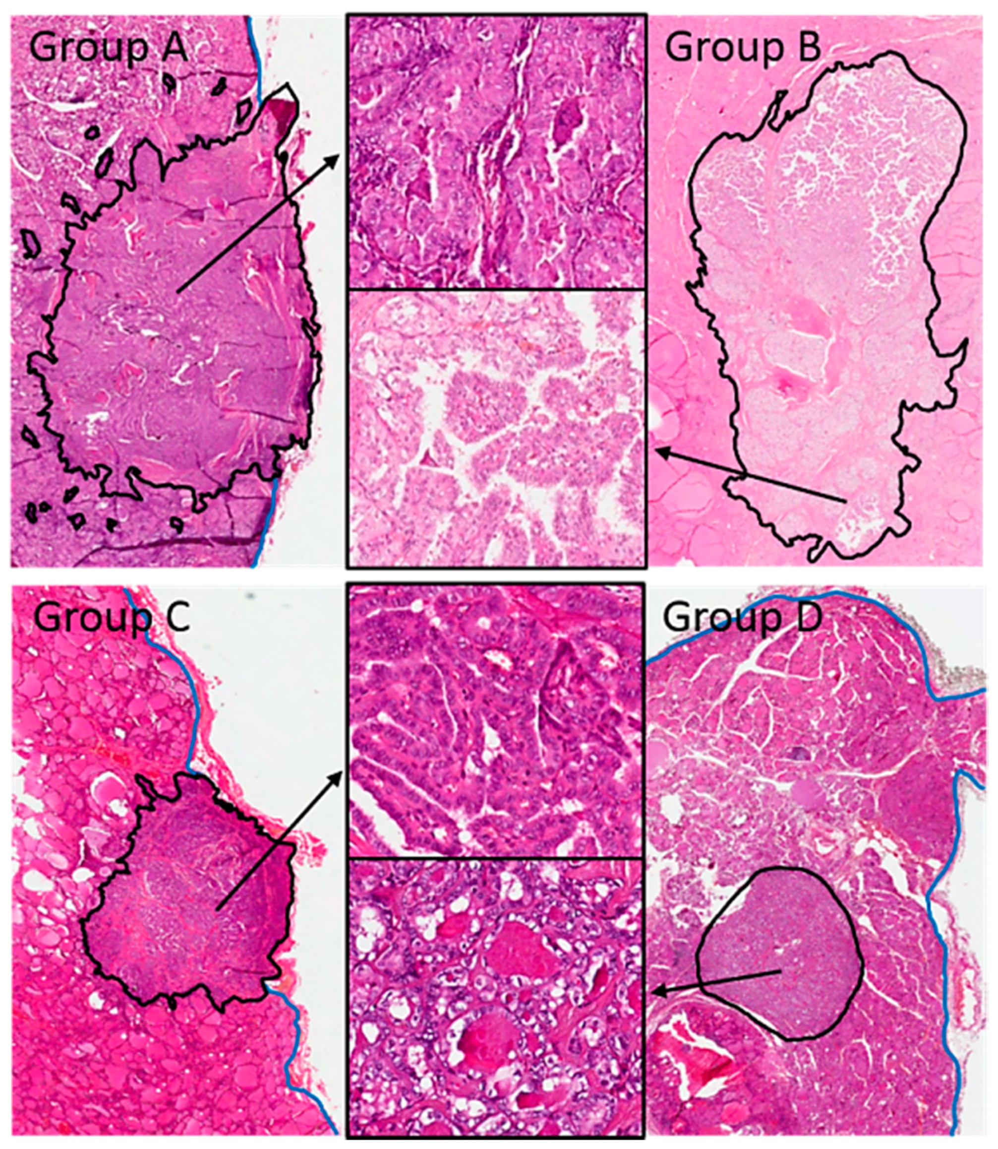 Cancers 12 00246 g005 Cancers 12 00246 g005