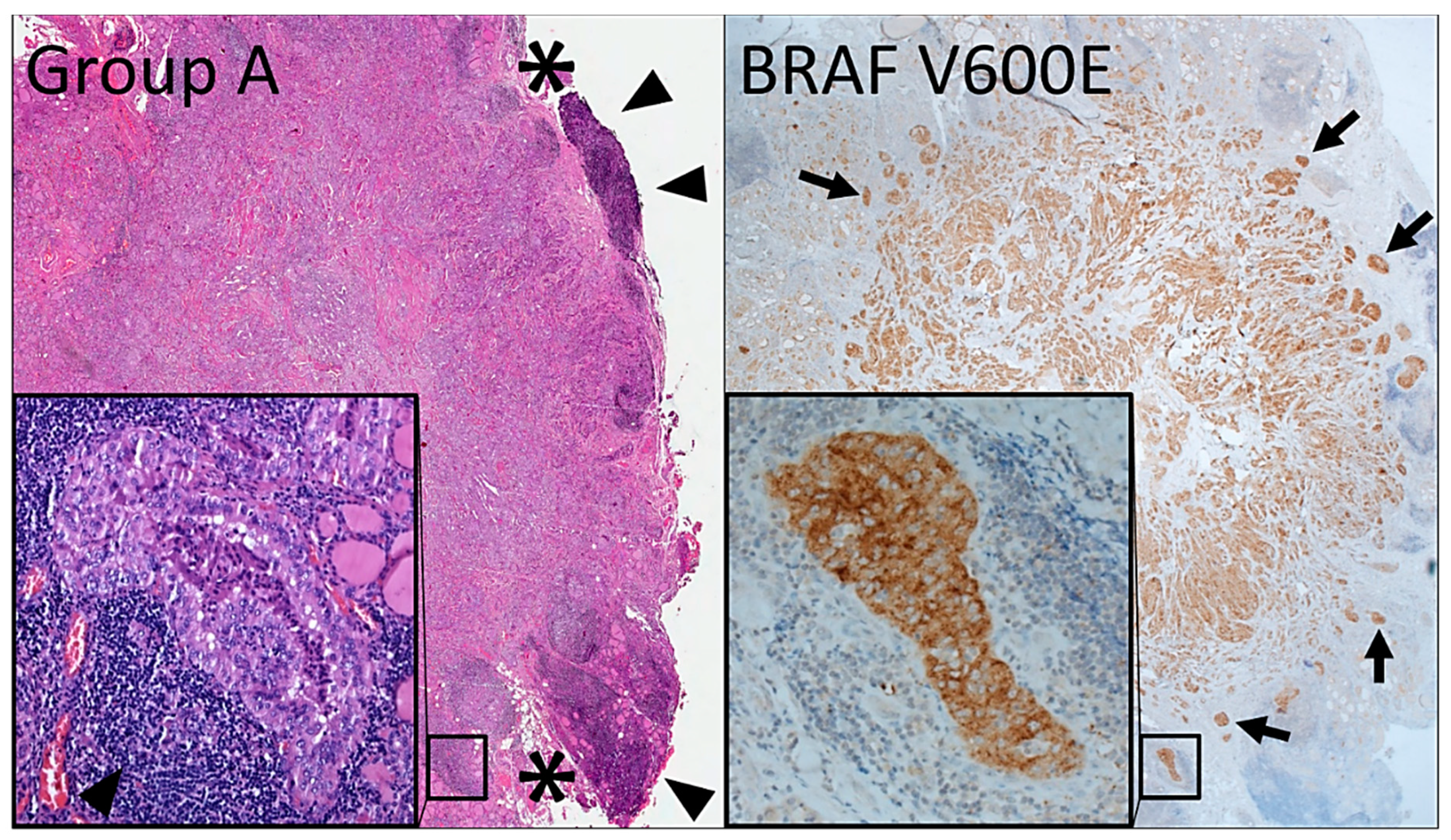 Cancers 12 00246 g006 Cancers 12 00246 g006