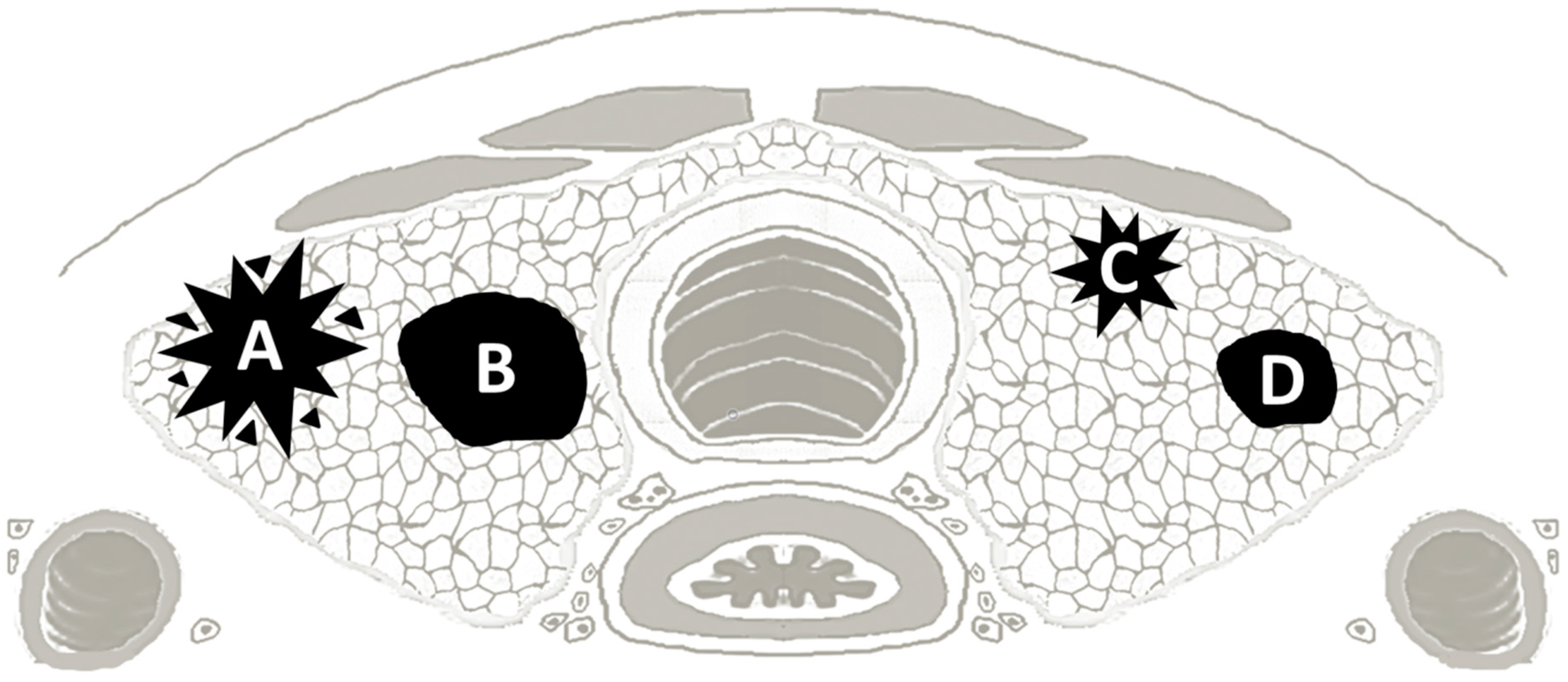 Cancers 12 00246 g007 Cancers 12 00246 g007