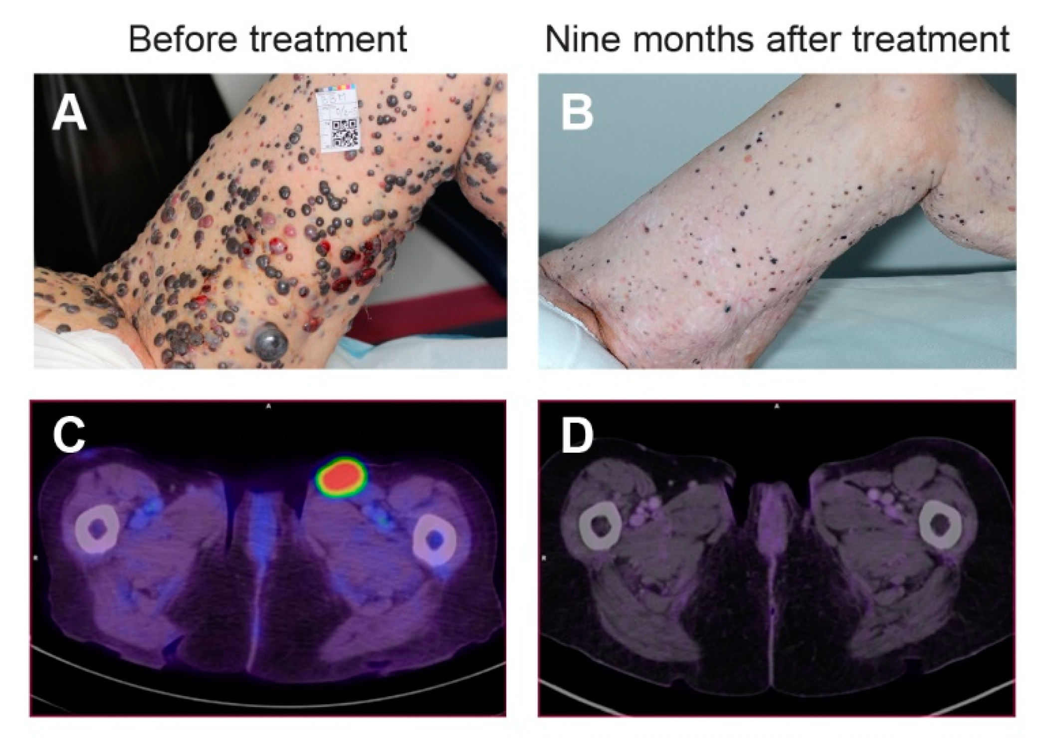 Cancers 12 00290 g005 Cancers 12 00290 g005