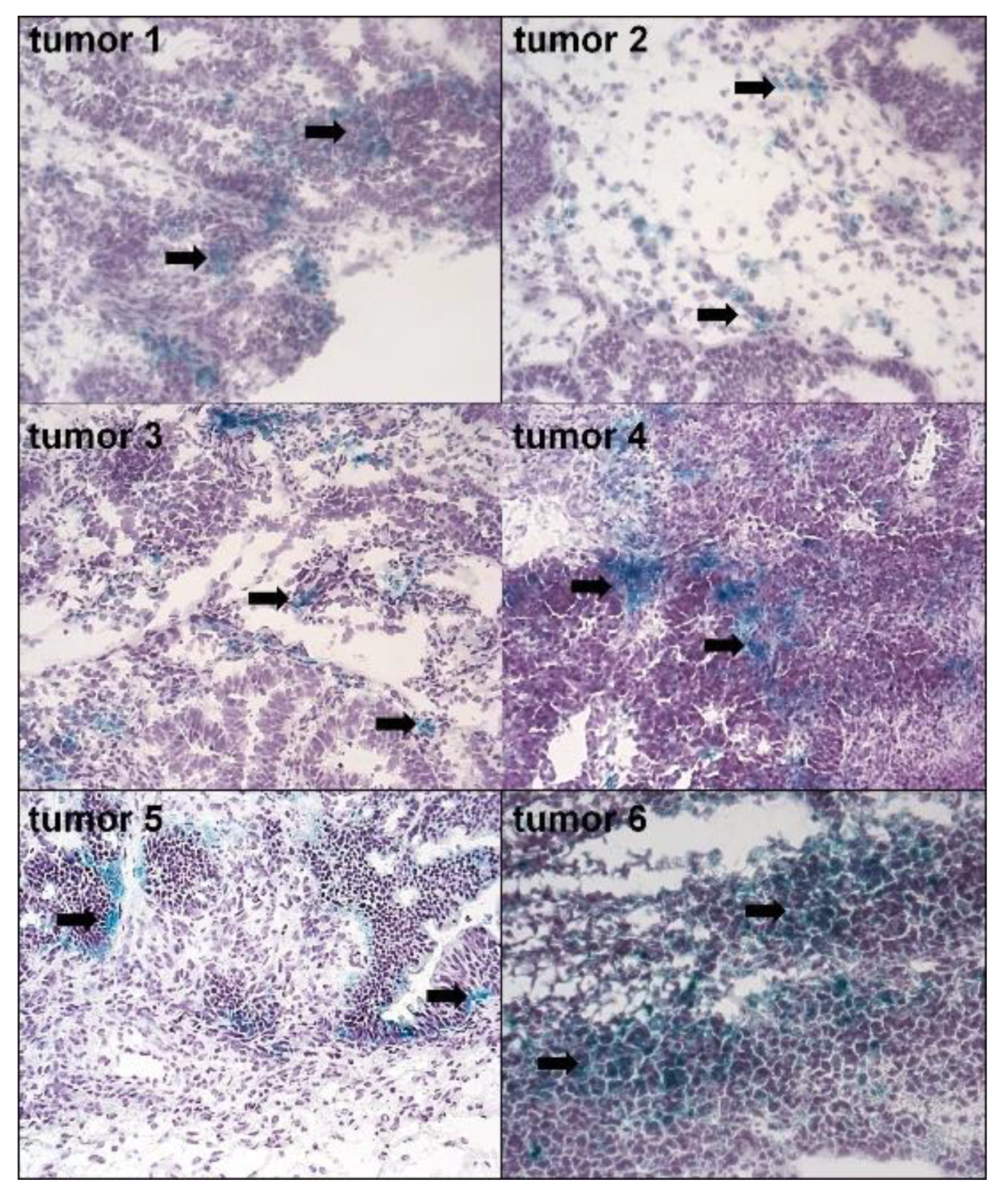Cancers 12 00296 g001 Cancers 12 00296 g001