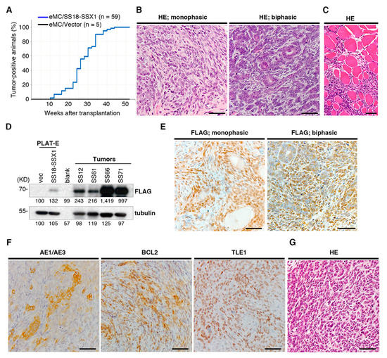 Cooperation between SS18-SSX1 and miR-214 in Synovial Sarcoma