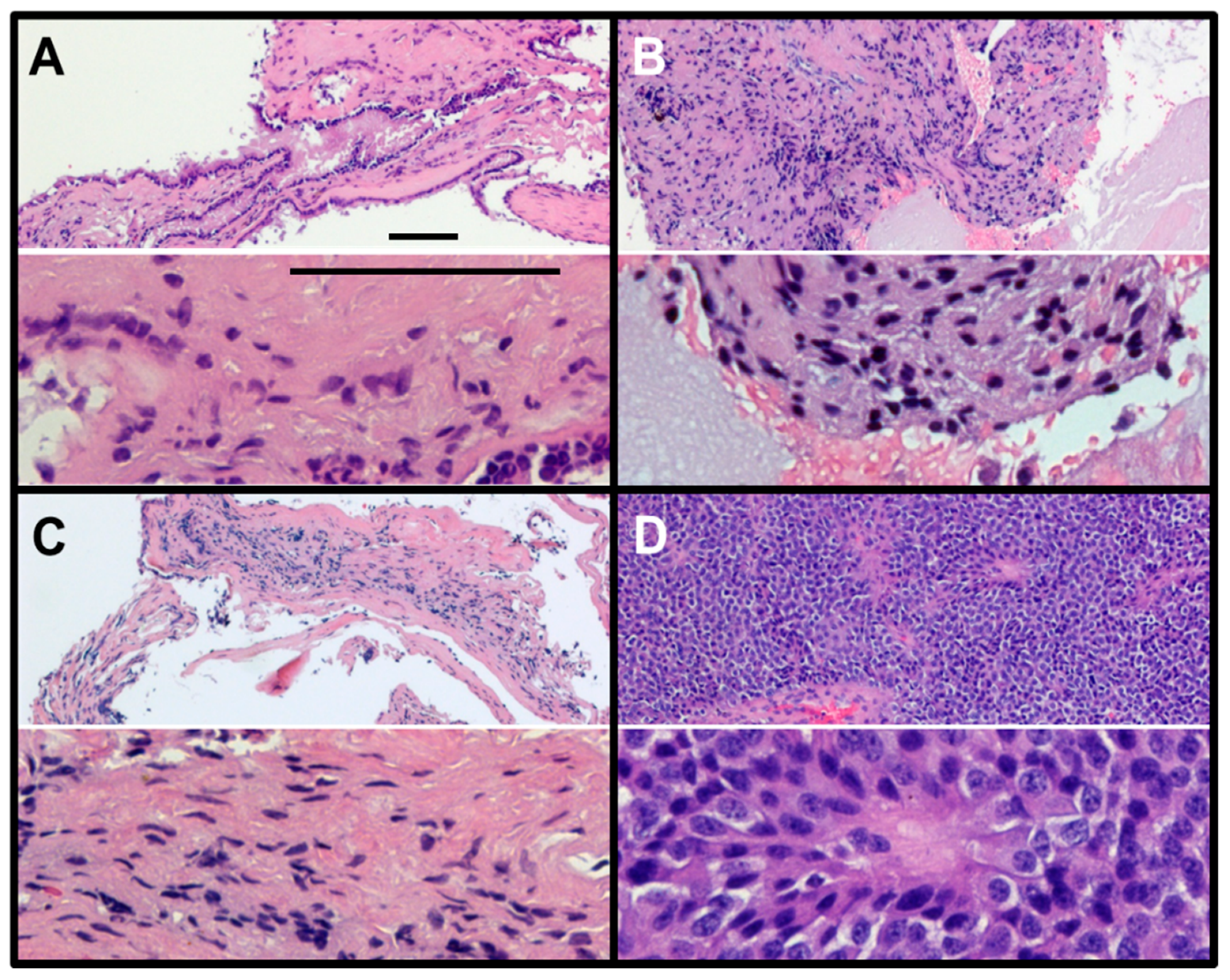 Cancers 12 00360 g003 Cancers 12 00360 g003