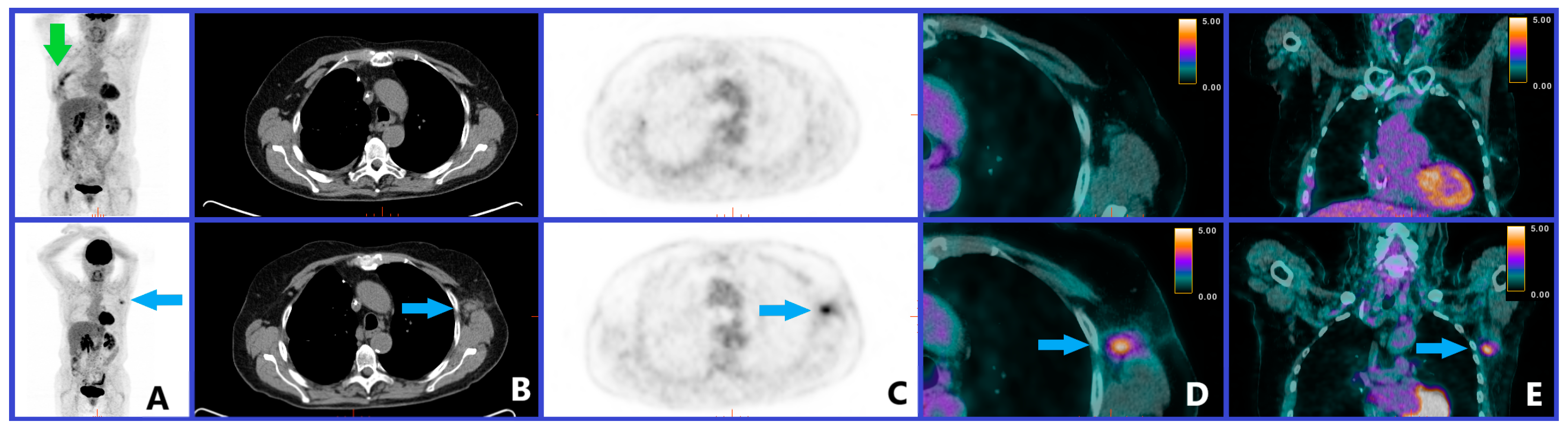 Cancers 12 00371 g004 Cancers 12 00371 g004