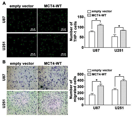 Monocarboxylate Transporter 4 Regulates Glioblastoma Motility and