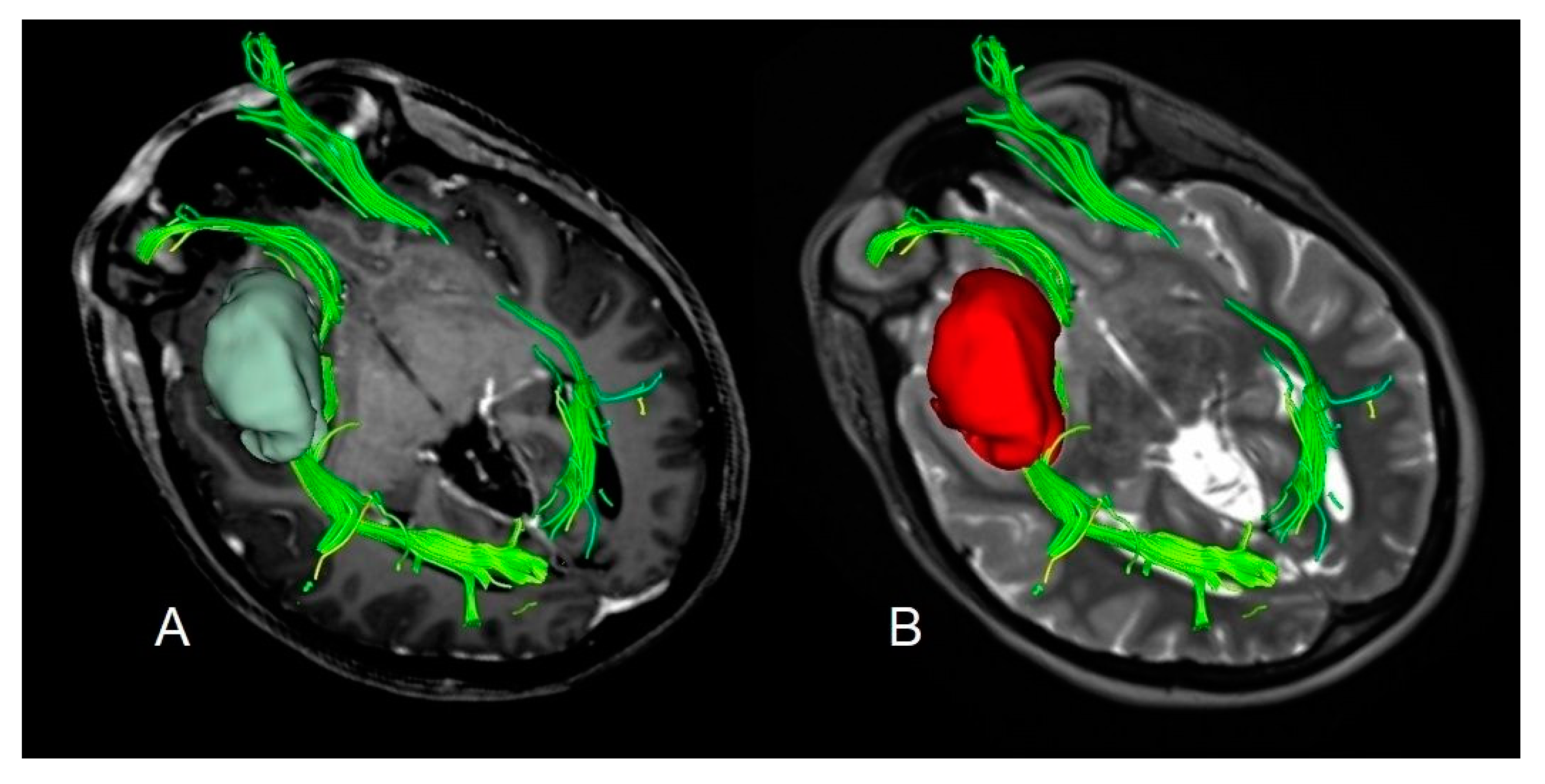 Cancers 12 00397 g004 Cancers 12 00397 g004