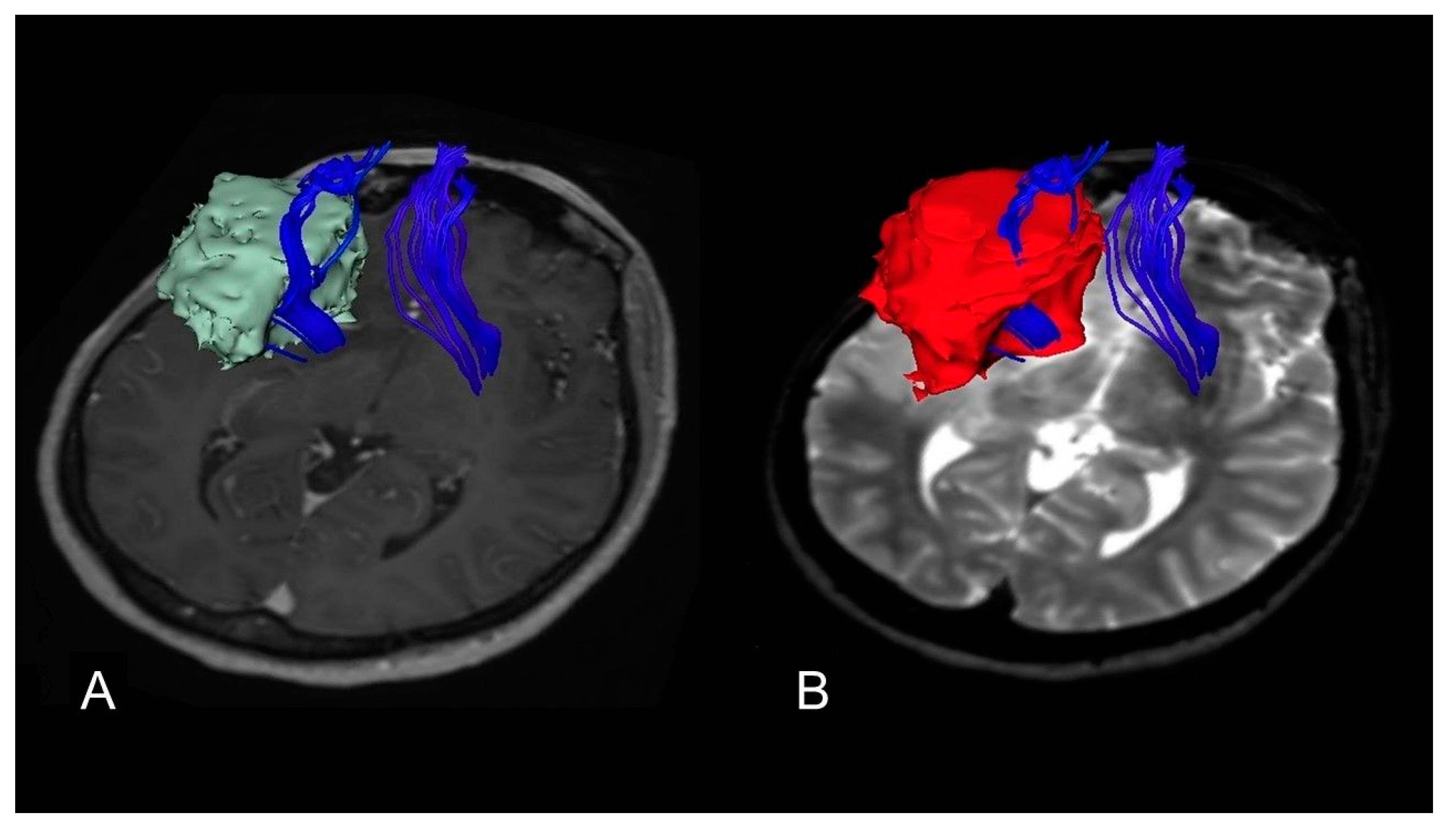 Cancers 12 00397 g005 Cancers 12 00397 g005