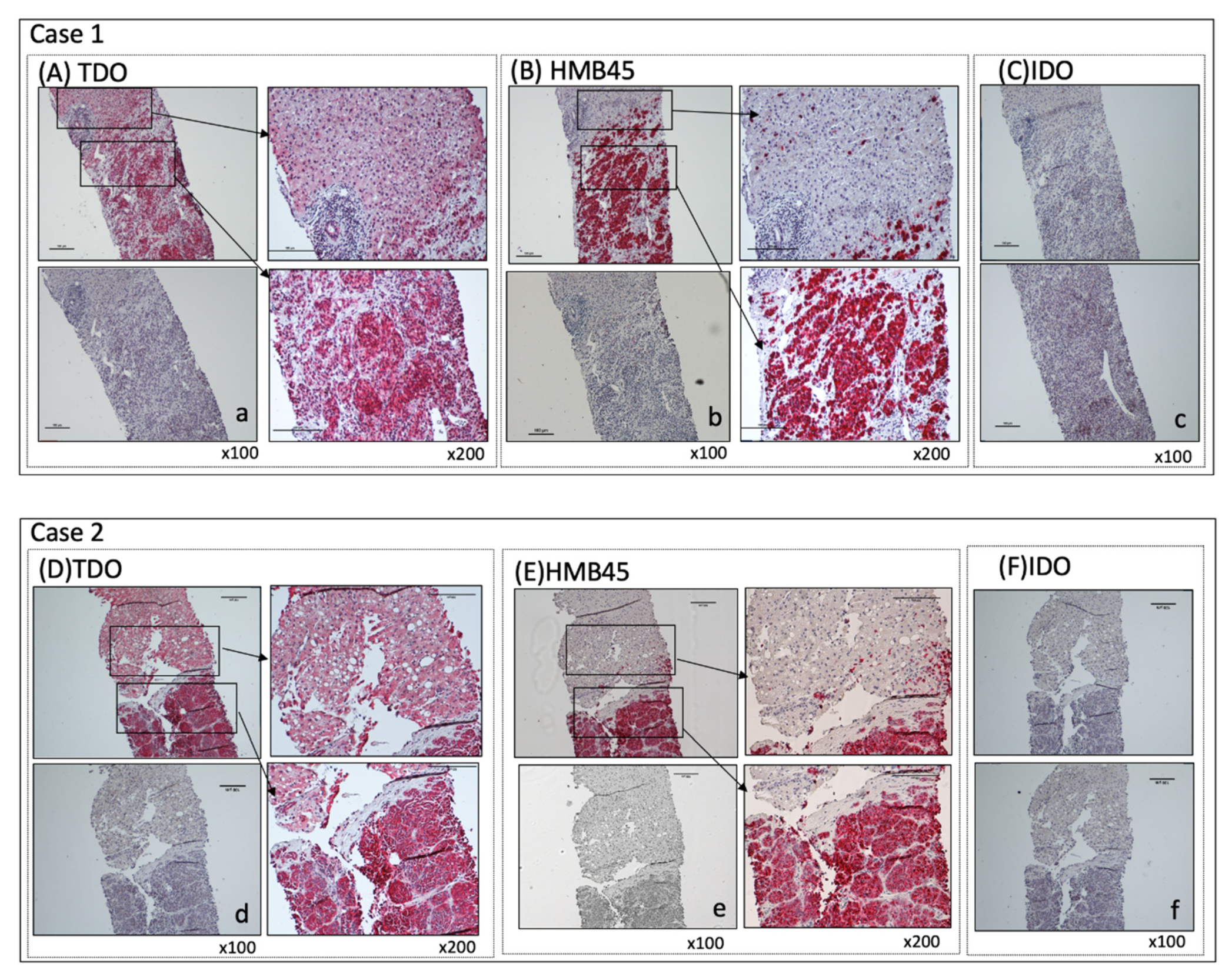 Cancers 12 00405 g001