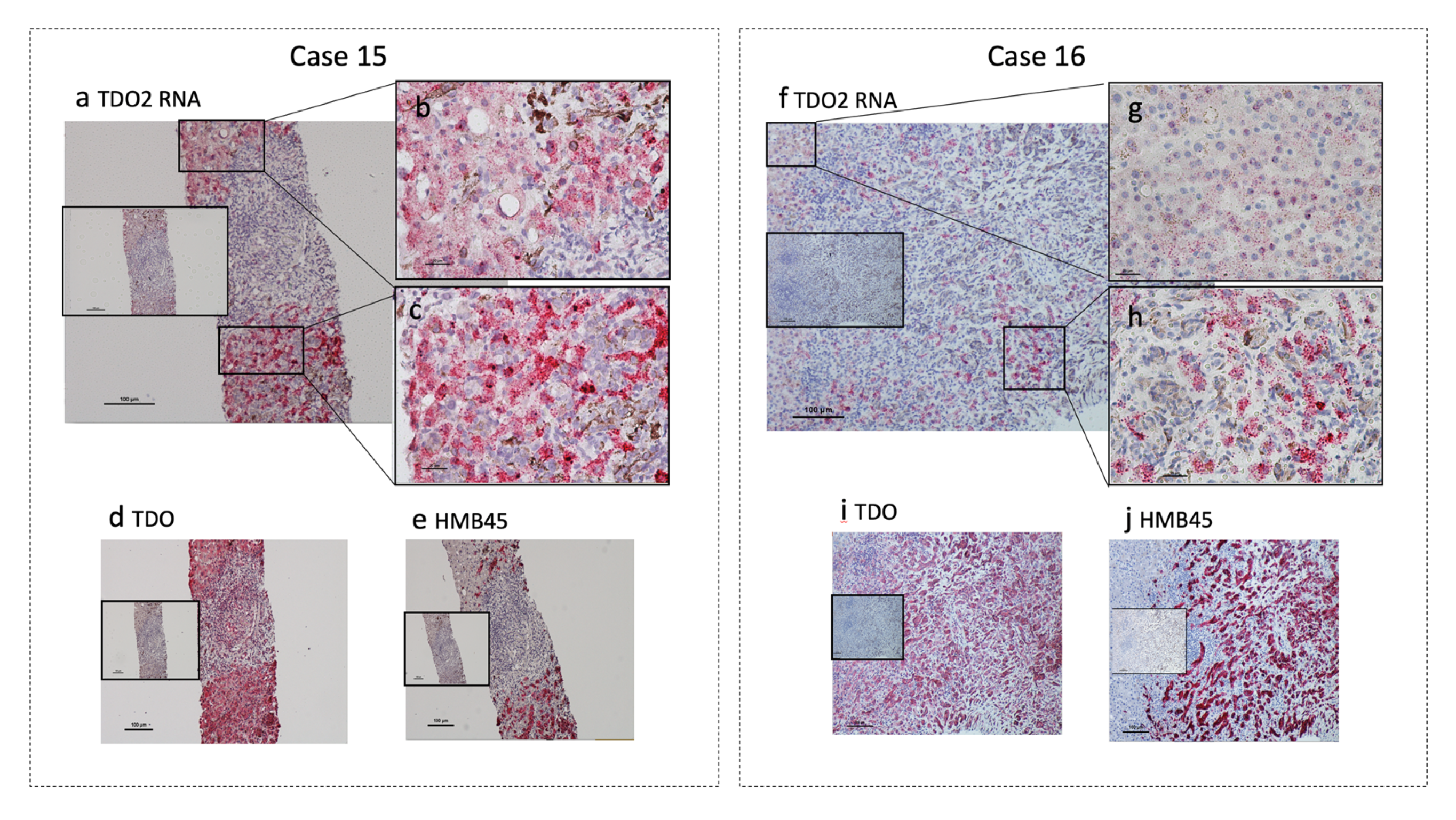 Cancers 12 00405 g002