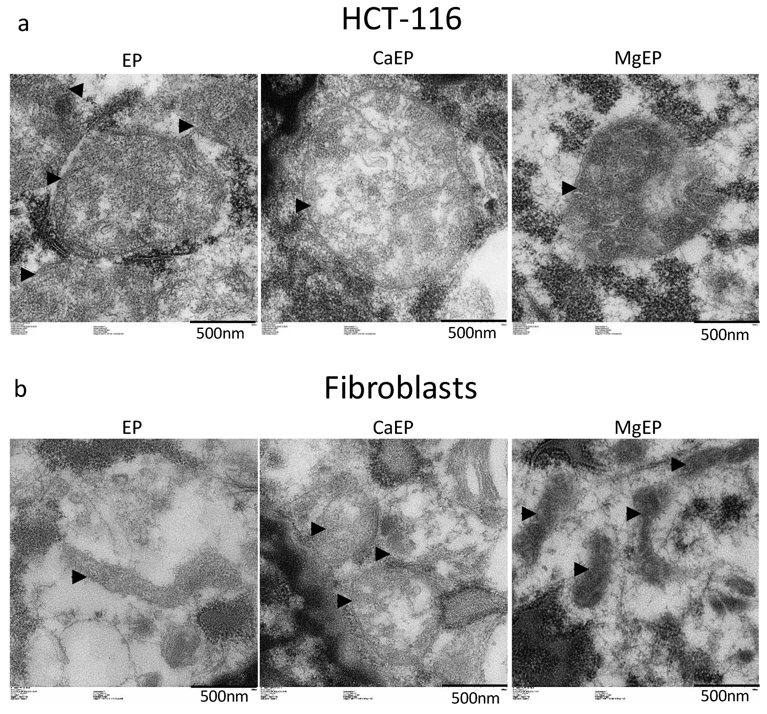 Cancers 12 00425 g005 Cancers 12 00425 g005