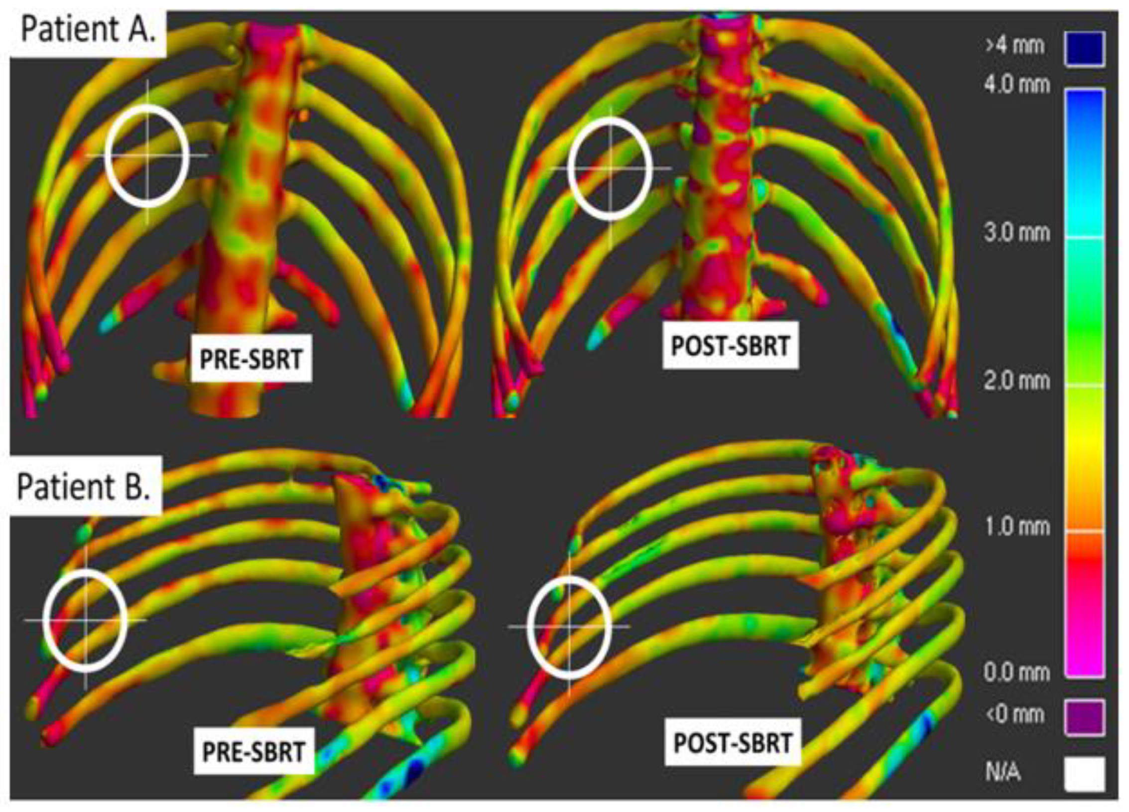 Cancers 12 00427 g004