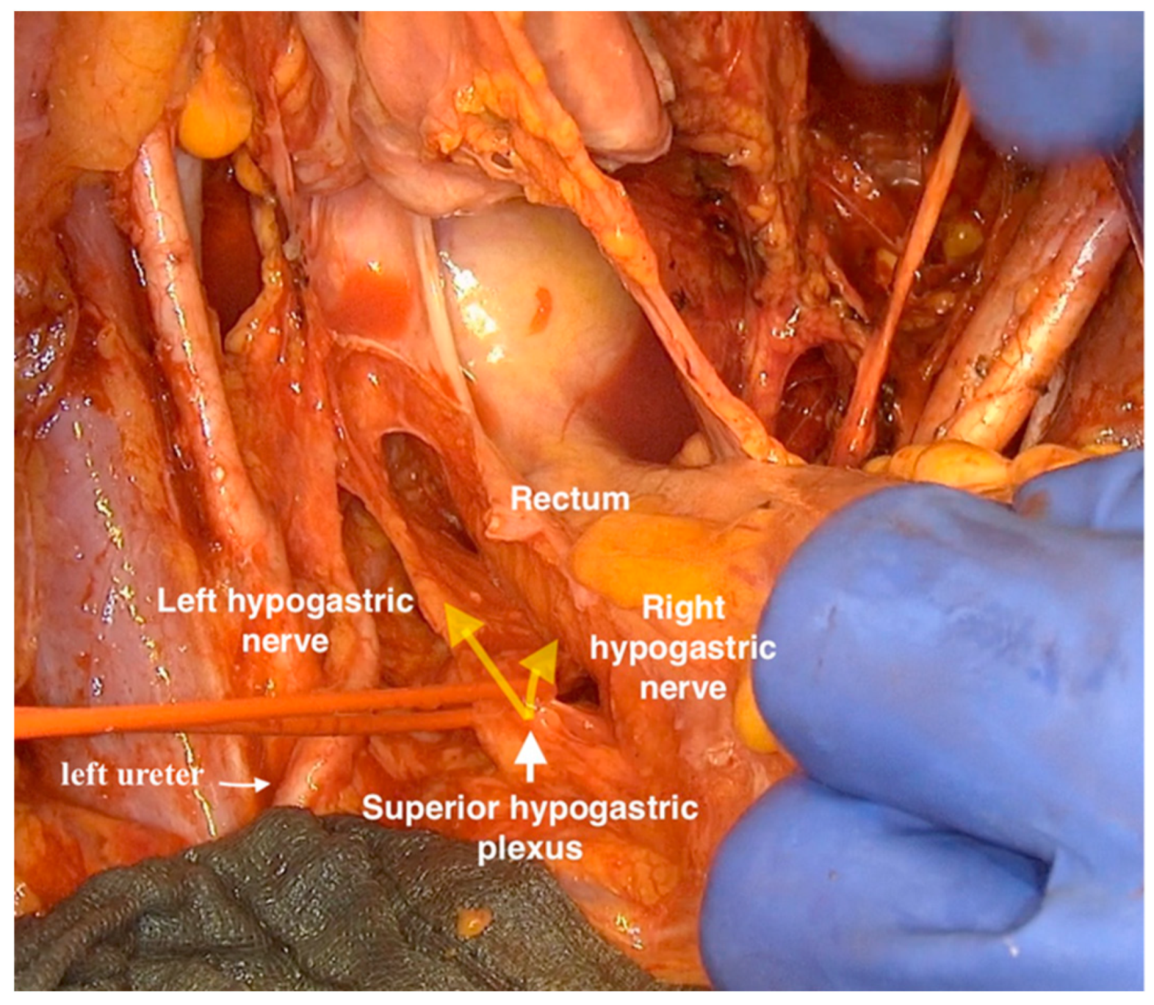 Cancers 12 00483 g002
