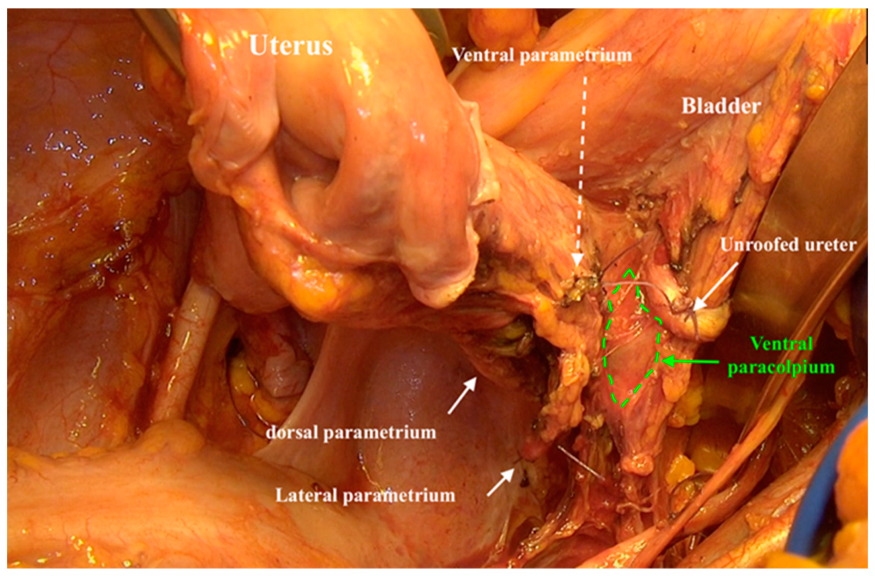 Cancers 12 00483 g005