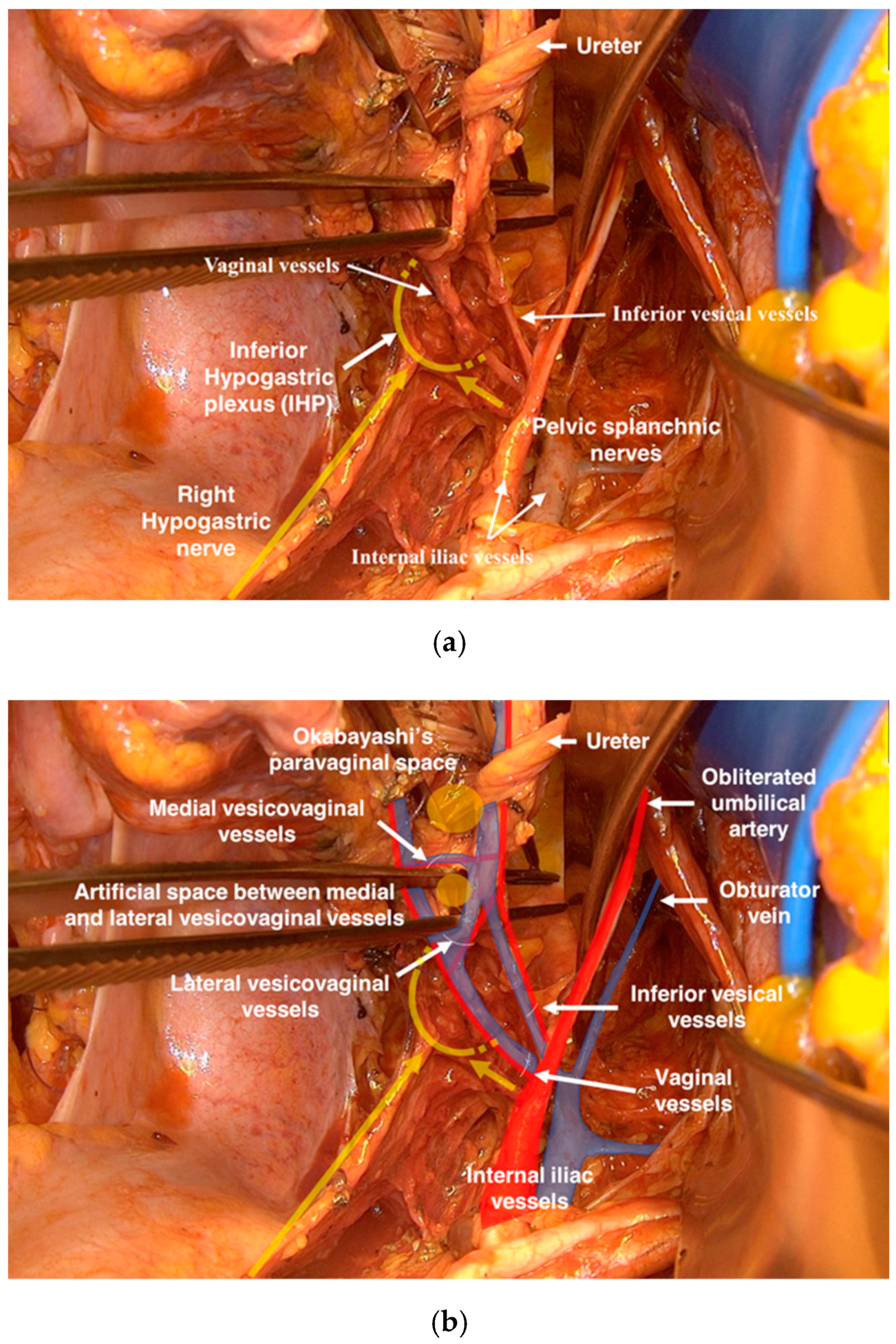 Cancers 12 00483 g006