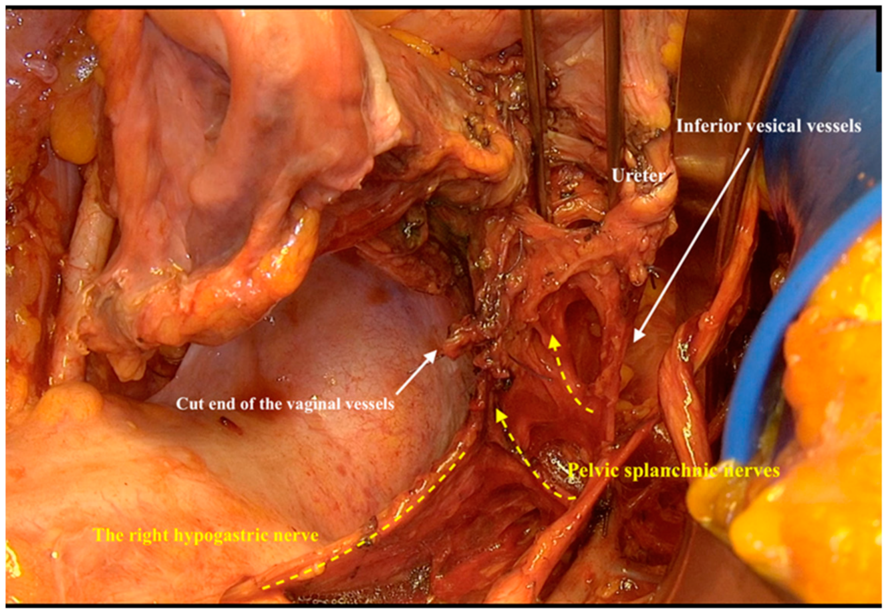 Cancers 12 00483 g007