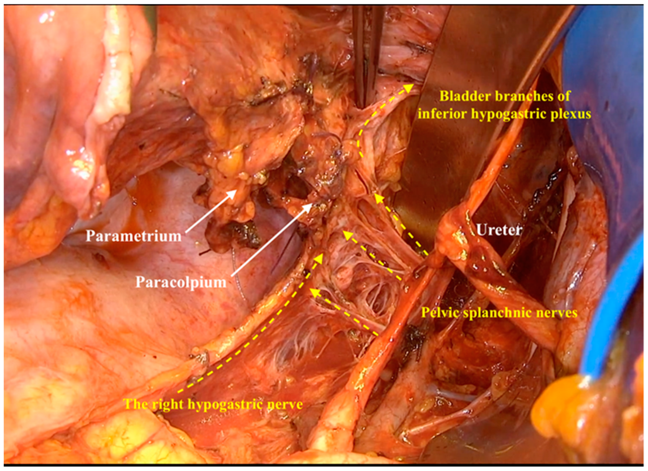 Cancers 12 00483 g008