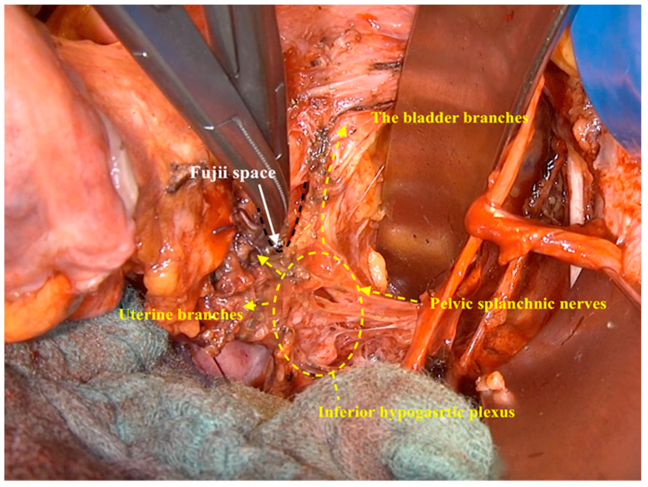 Cancers 12 00483 g009