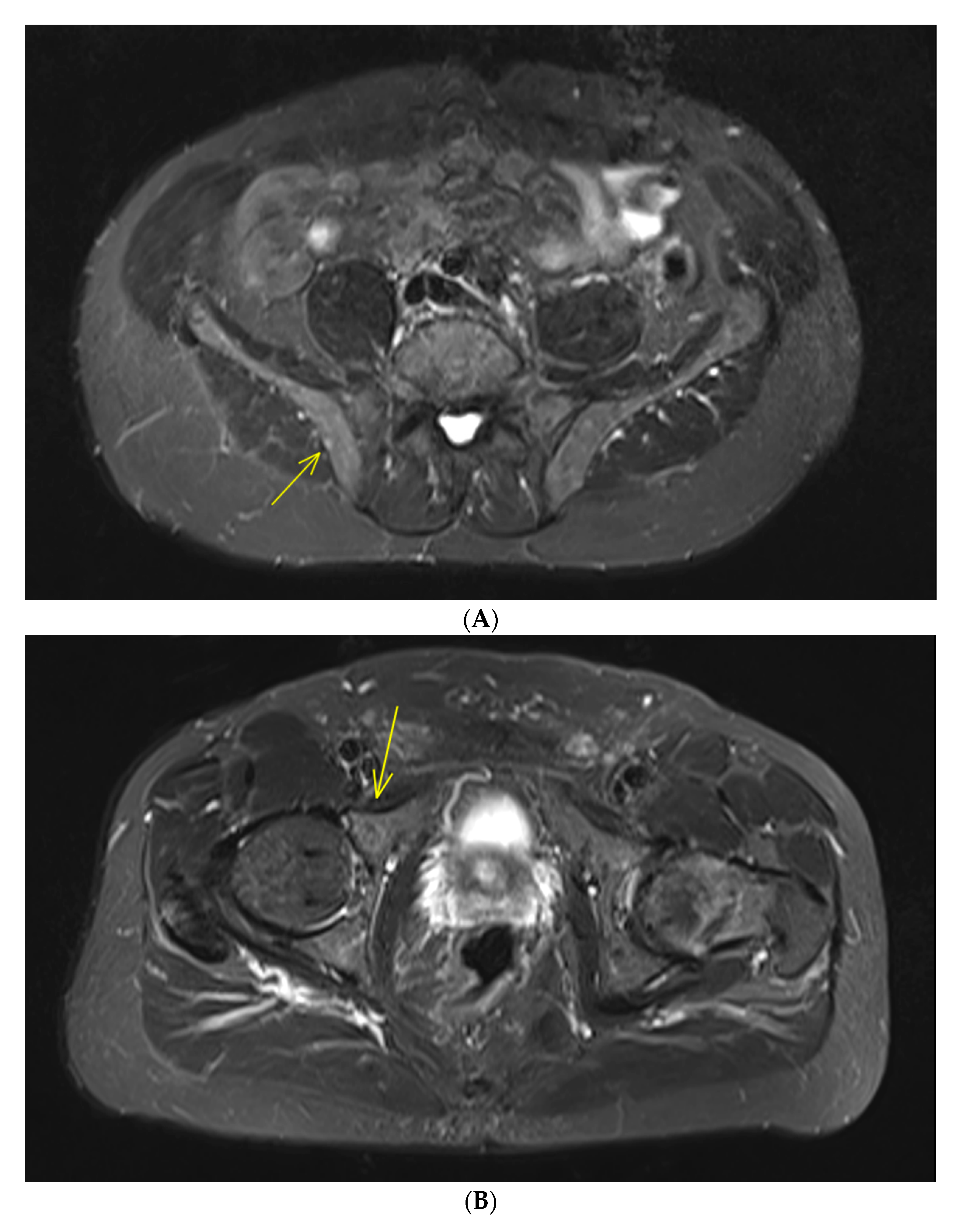 Cancers 12 00486 g001a Cancers 12 00486 g001a