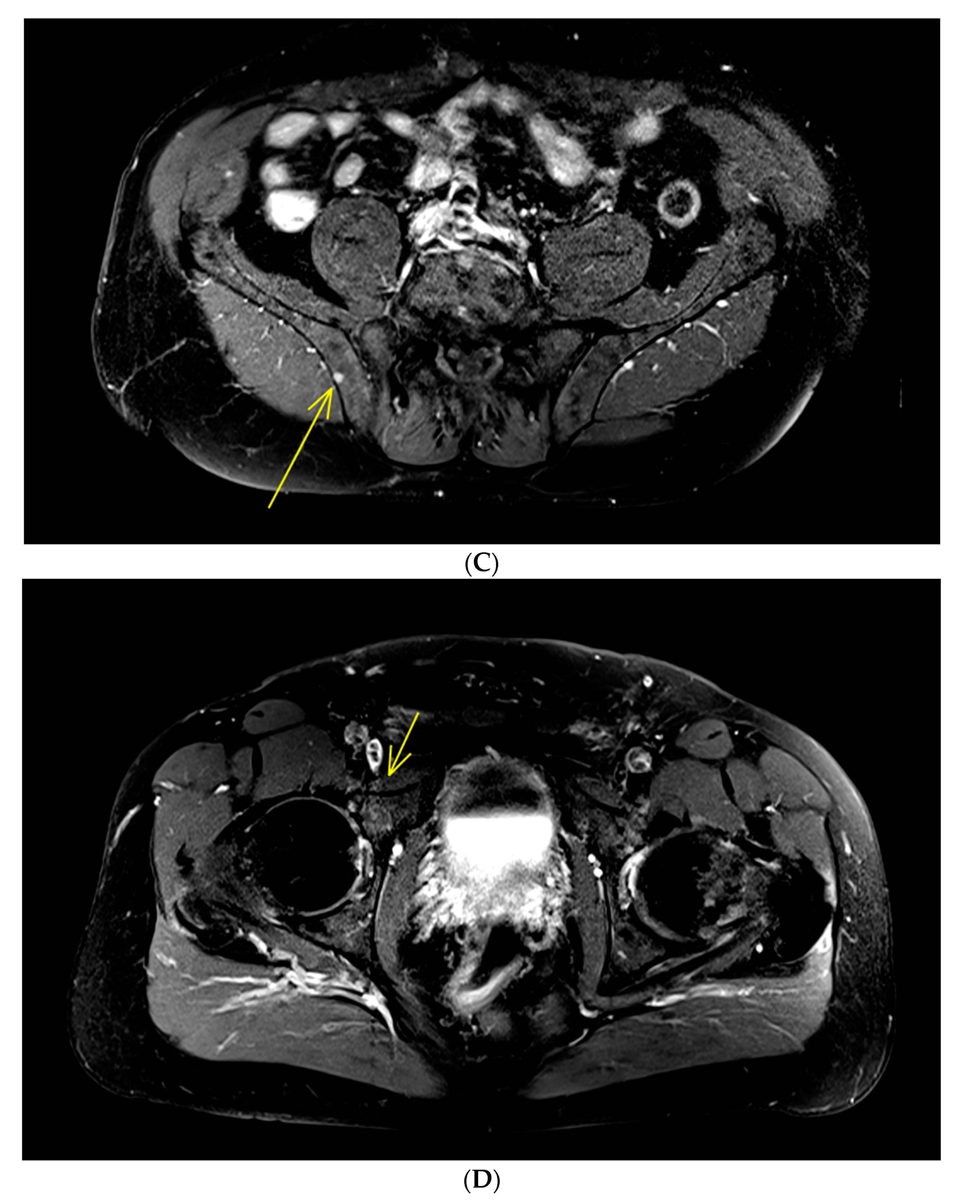 Cancers 12 00486 g001b Cancers 12 00486 g001b