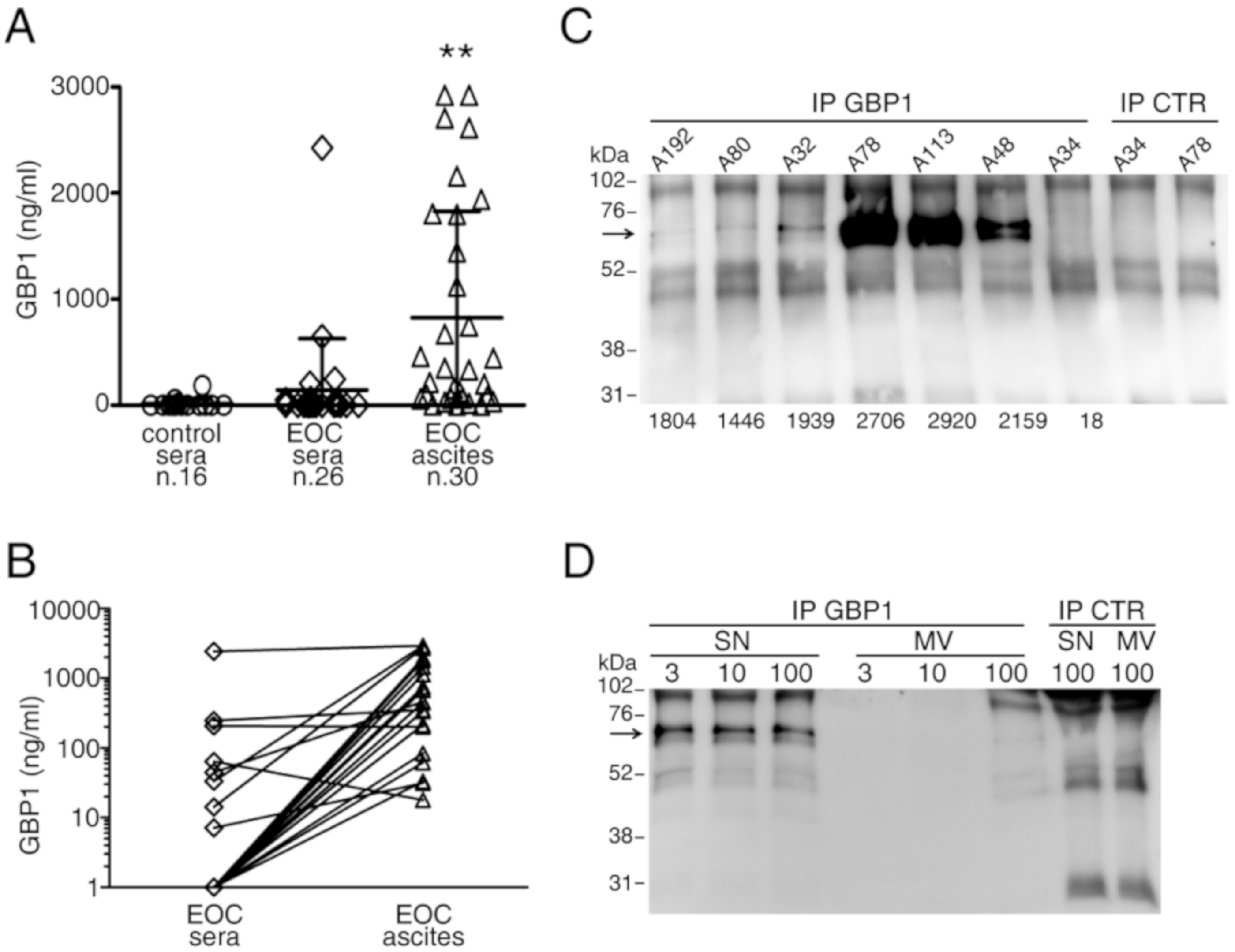 Cancers 12 00488 g005 Cancers 12 00488 g005