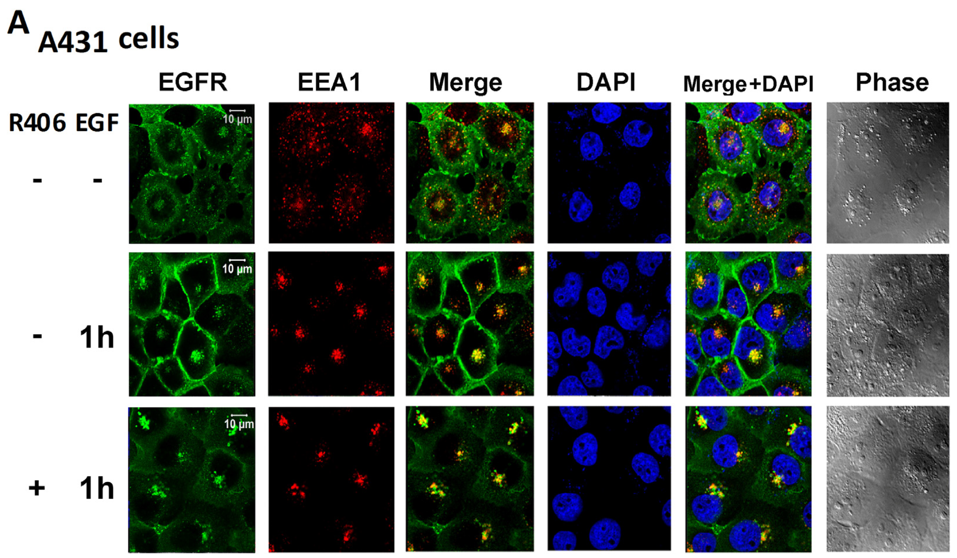 Cancers 12 00489 g005a Cancers 12 00489 g005a