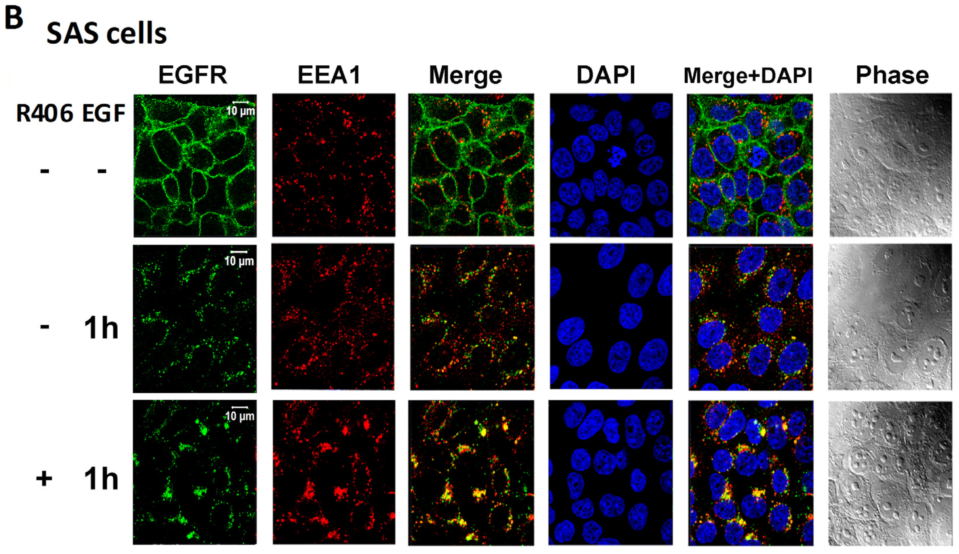 Cancers 12 00489 g005b Cancers 12 00489 g005b
