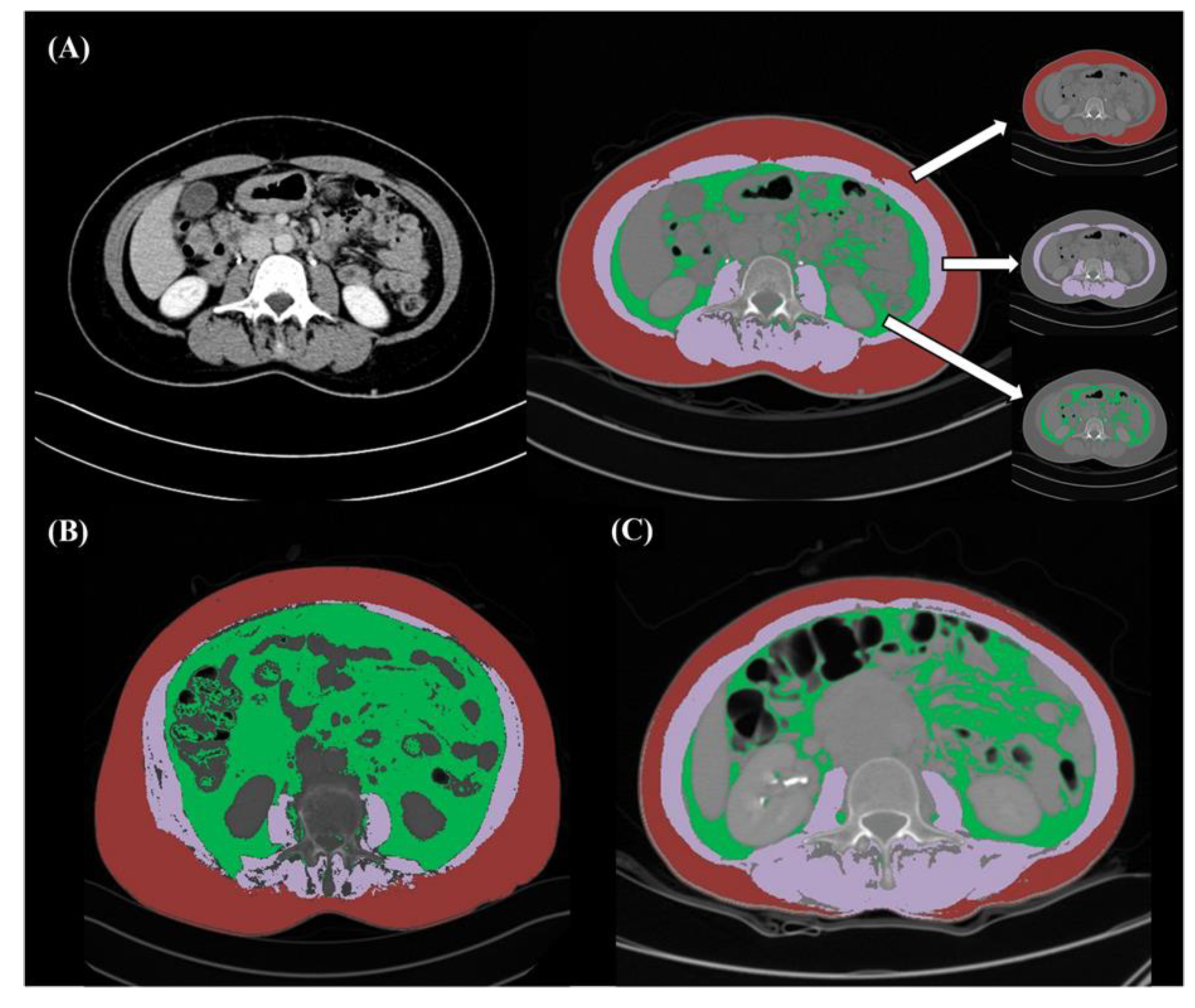Cancers 12 00559 g004 Cancers 12 00559 g004