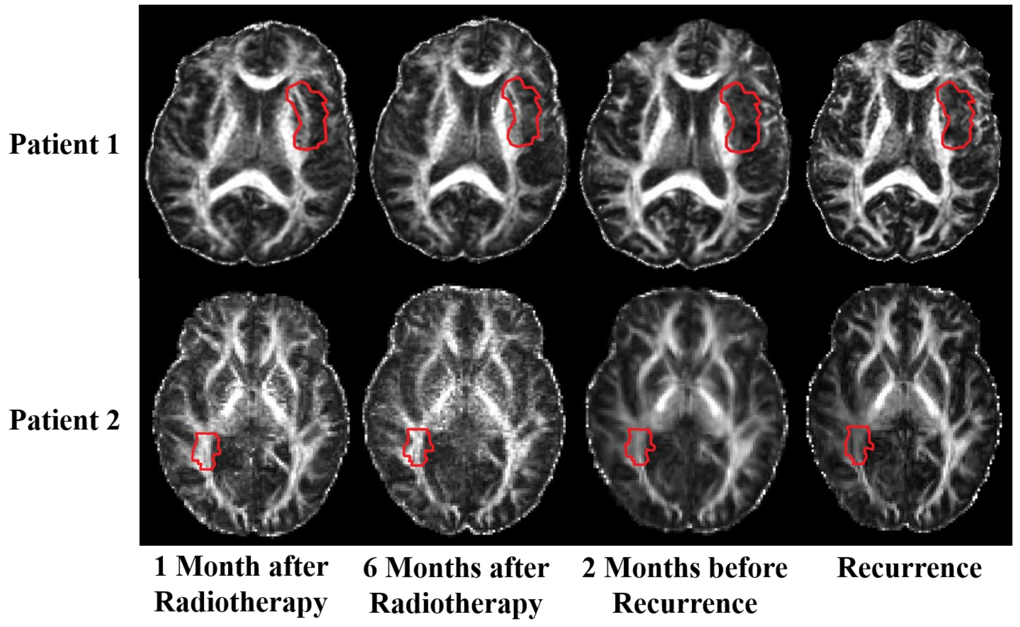 Cancers 12 00568 g005
