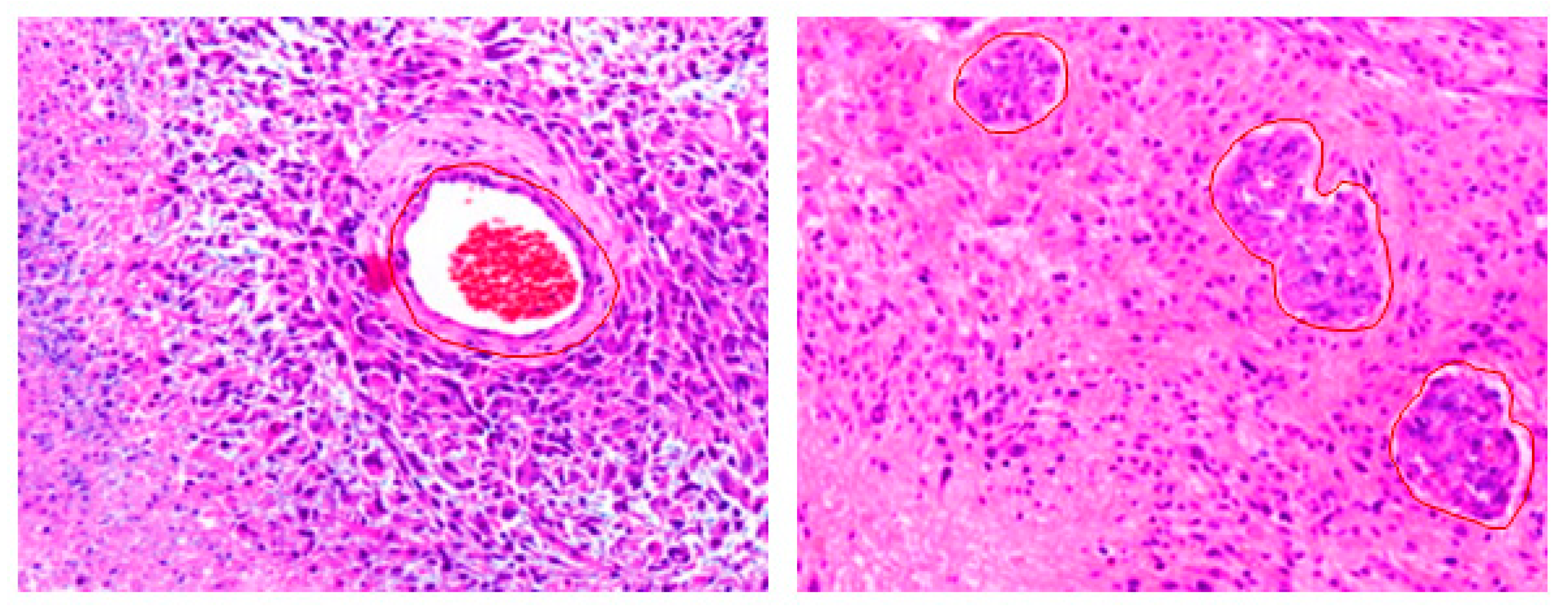 Cancers 12 00578 g004