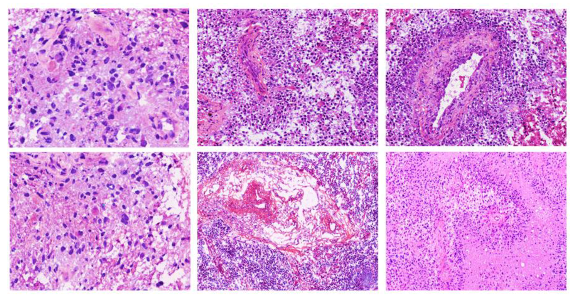 Cancers 12 00578 g005