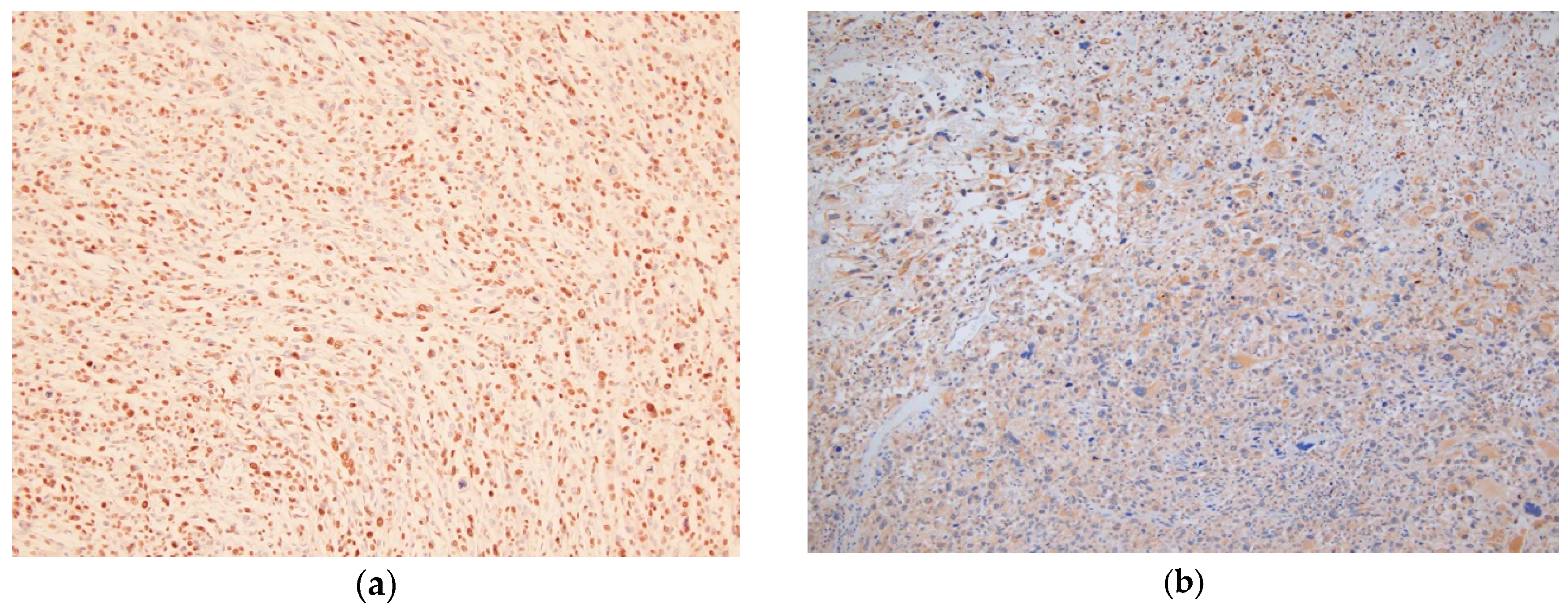 Cancers 12 00585 g003