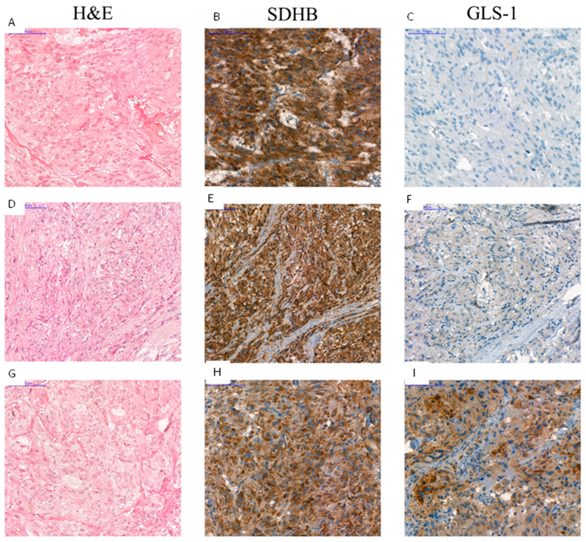 Cancers 12 00599 g007 Cancers 12 00599 g007