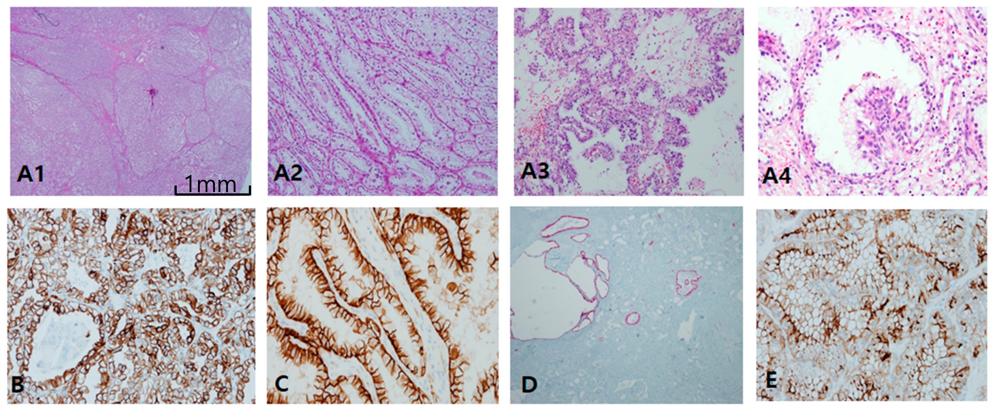 Cancers 12 00602 g003 Cancers 12 00602 g003