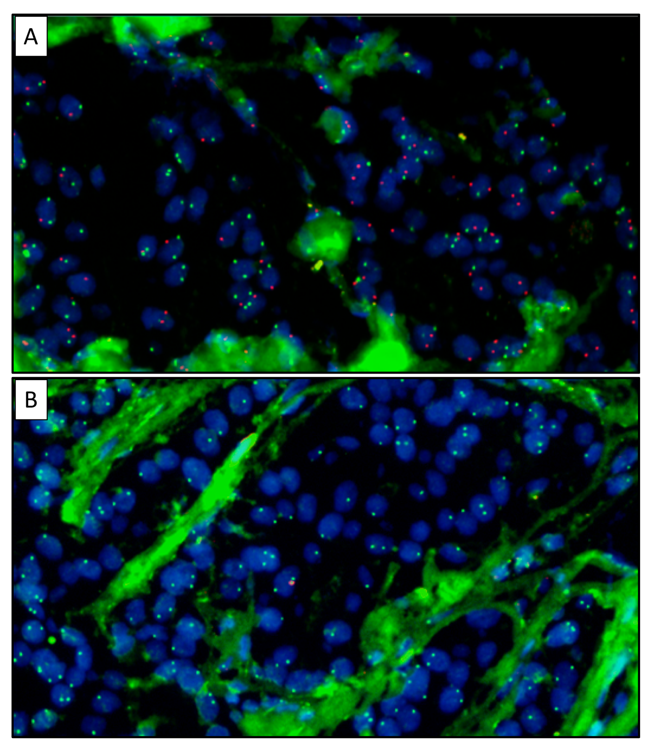 Cancers 12 00631 g002