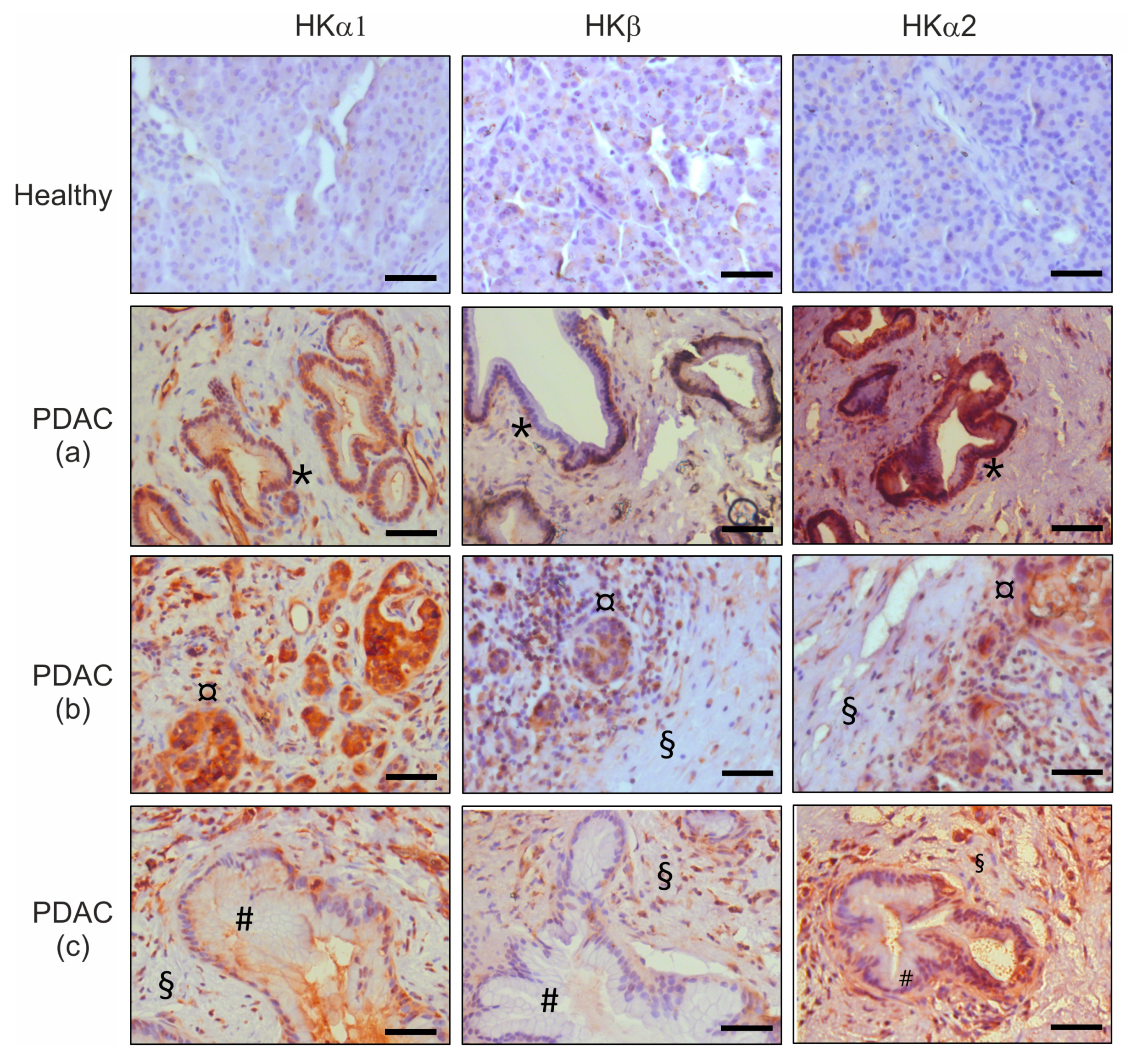 Cancers 12 00640 g002